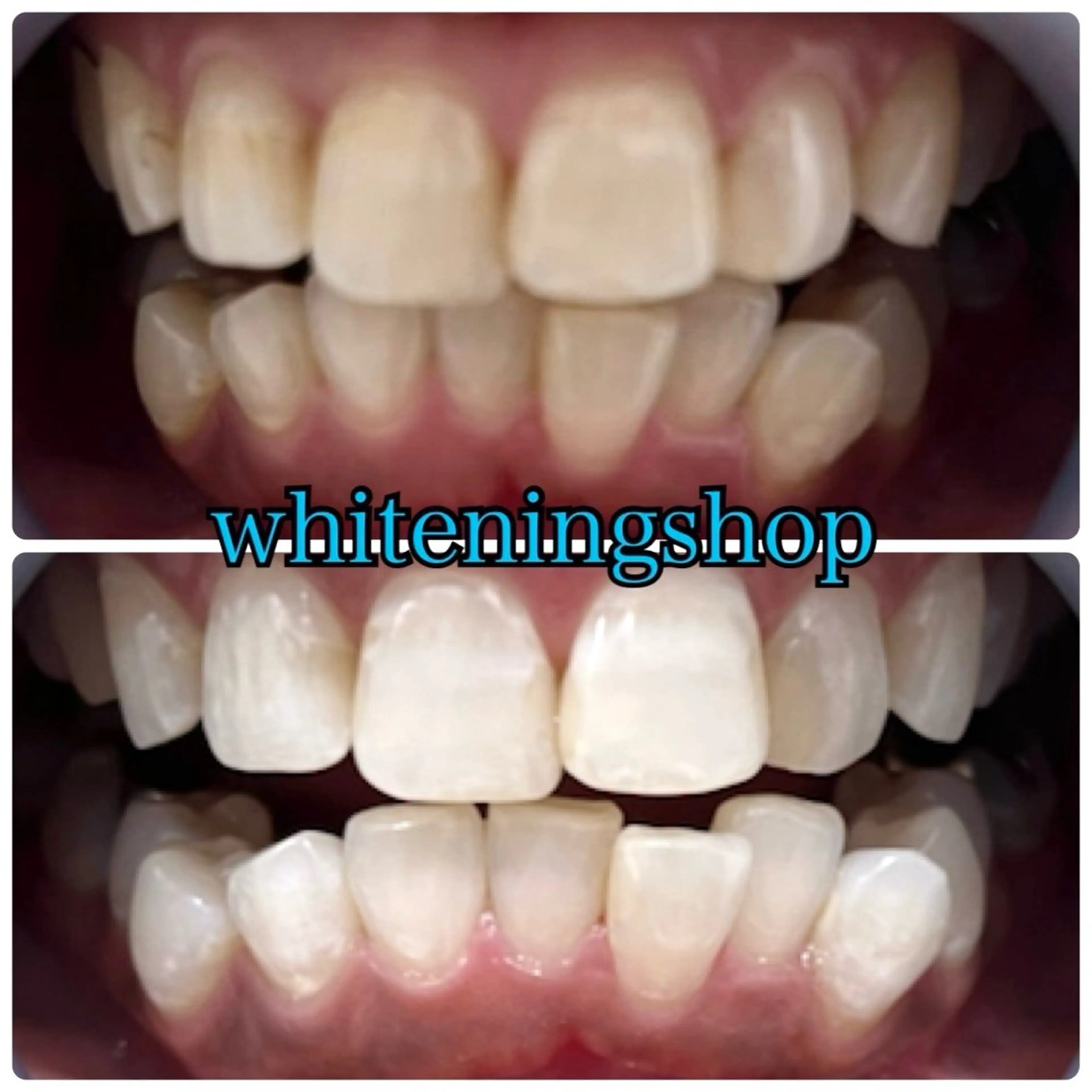 メンズ エステ リラク ホワイトニング ショップ川越店のエステ・リラクイメージ