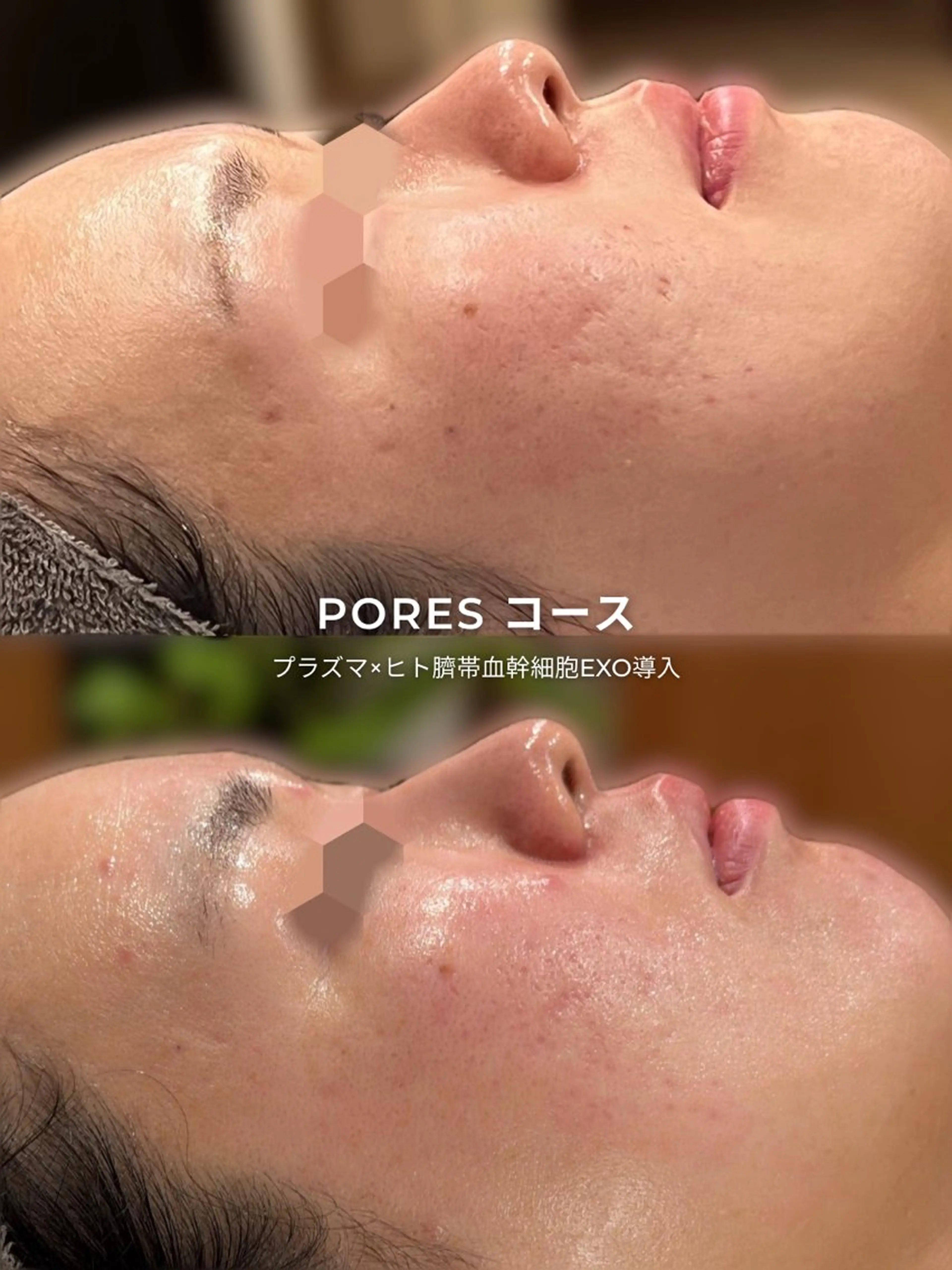 エステ リラク CURATED SKIN｜神戸三宮のエステ・リラクイメージ