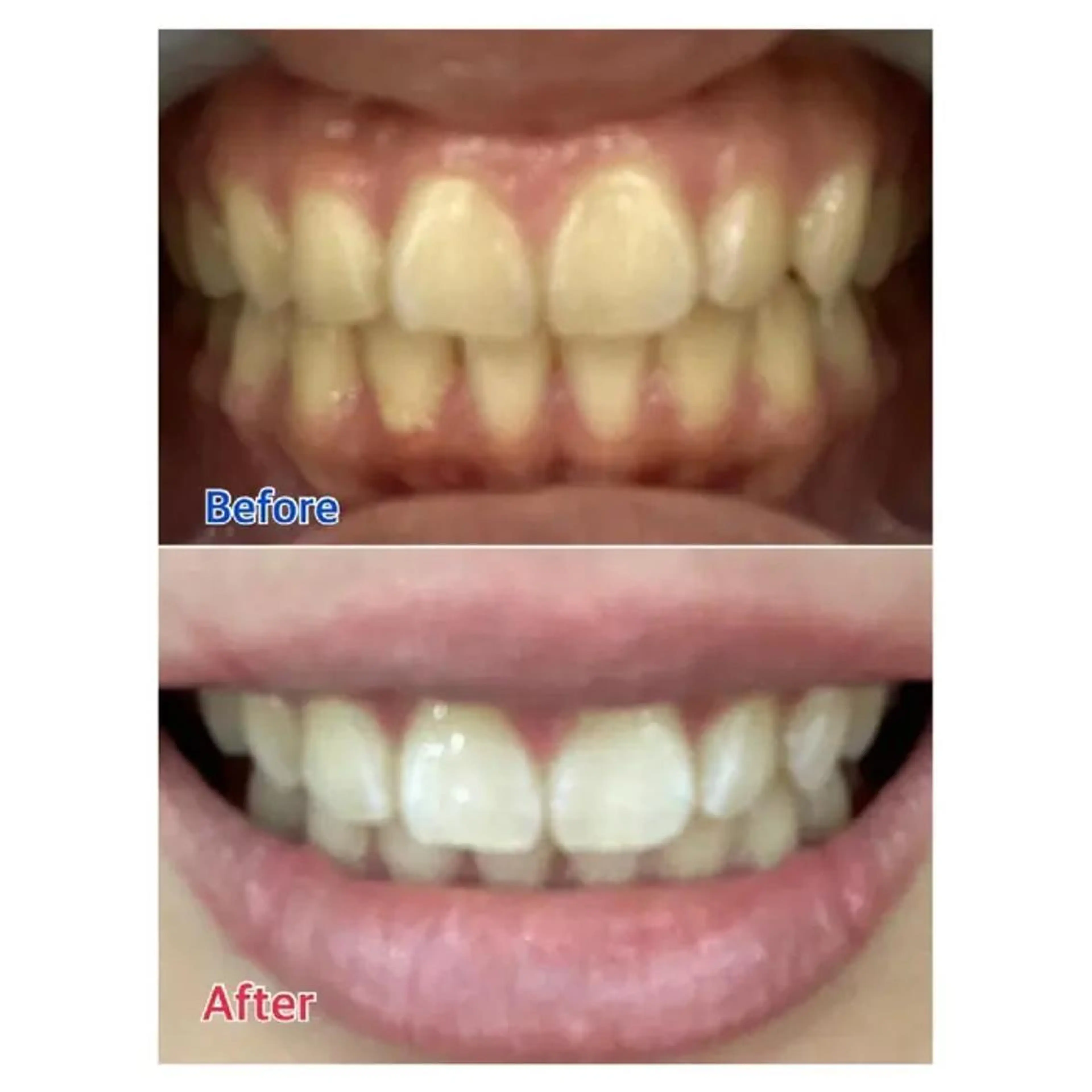 M渋谷店所属・Ｍ渋谷 ホワイトニングのその他イメージ