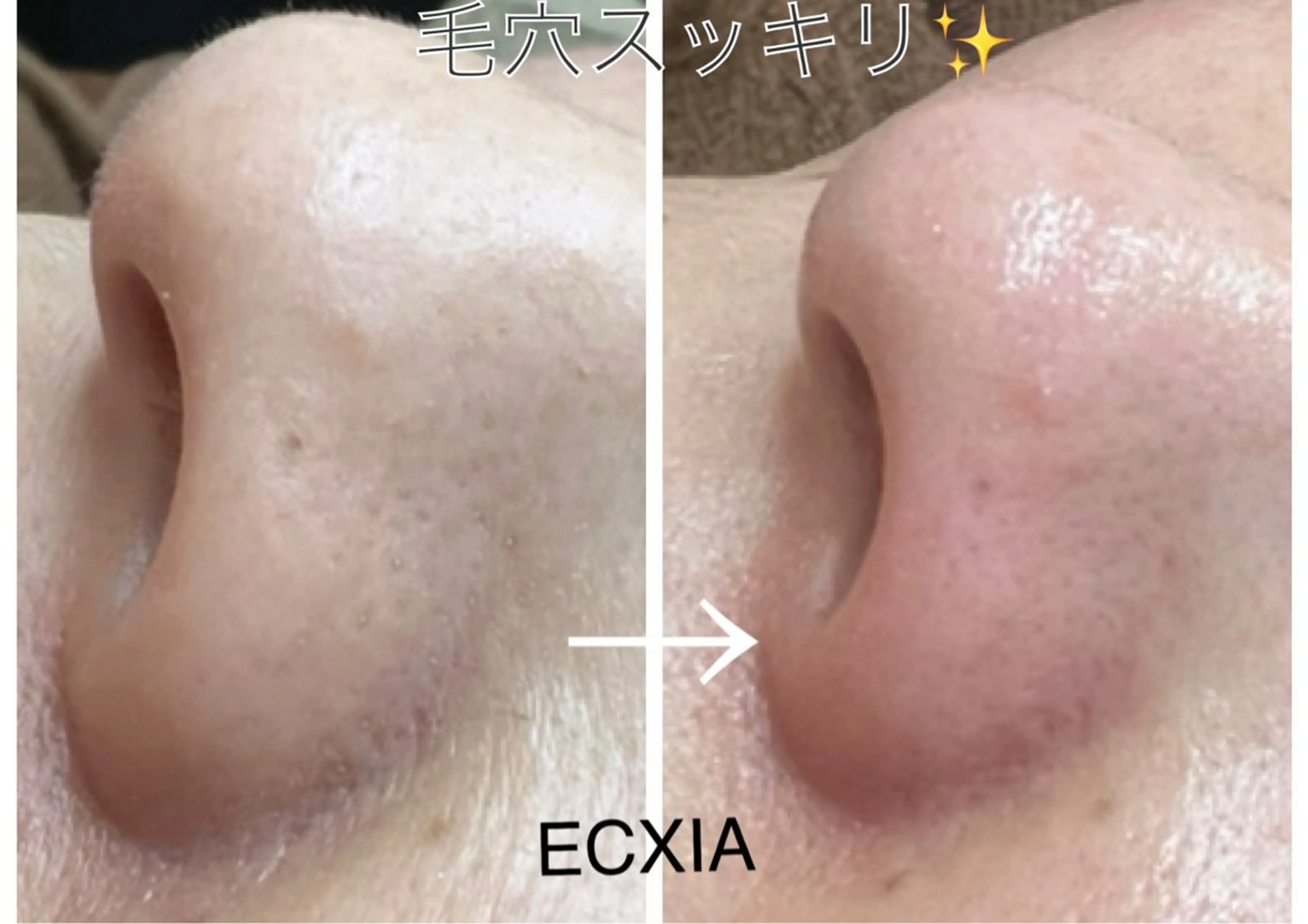 エステ ECXIA 【エクシア】のエステ・リラクイメージ