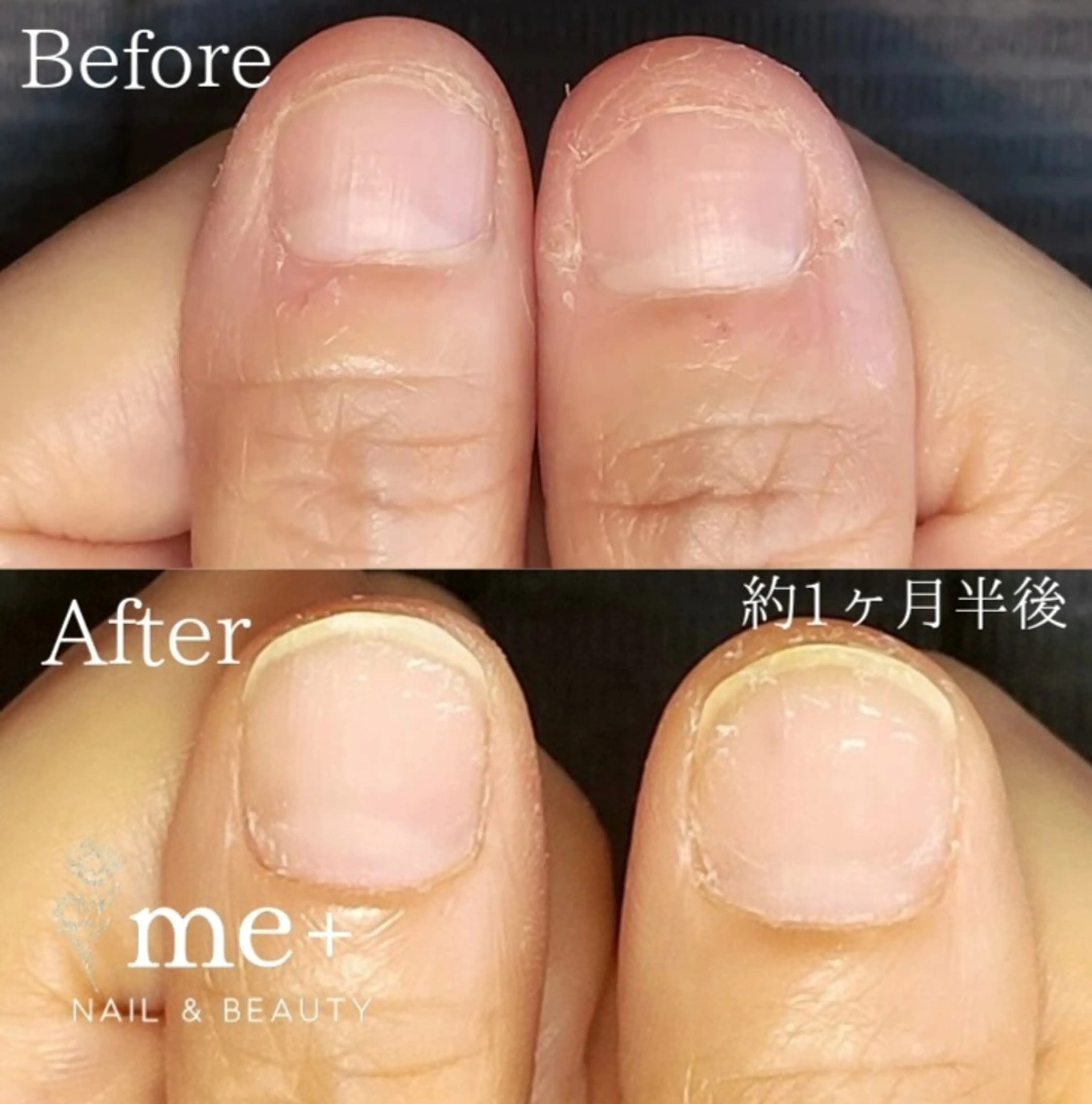 ネイル 【豊中駅徒歩2分】 me+のネイルデザイン