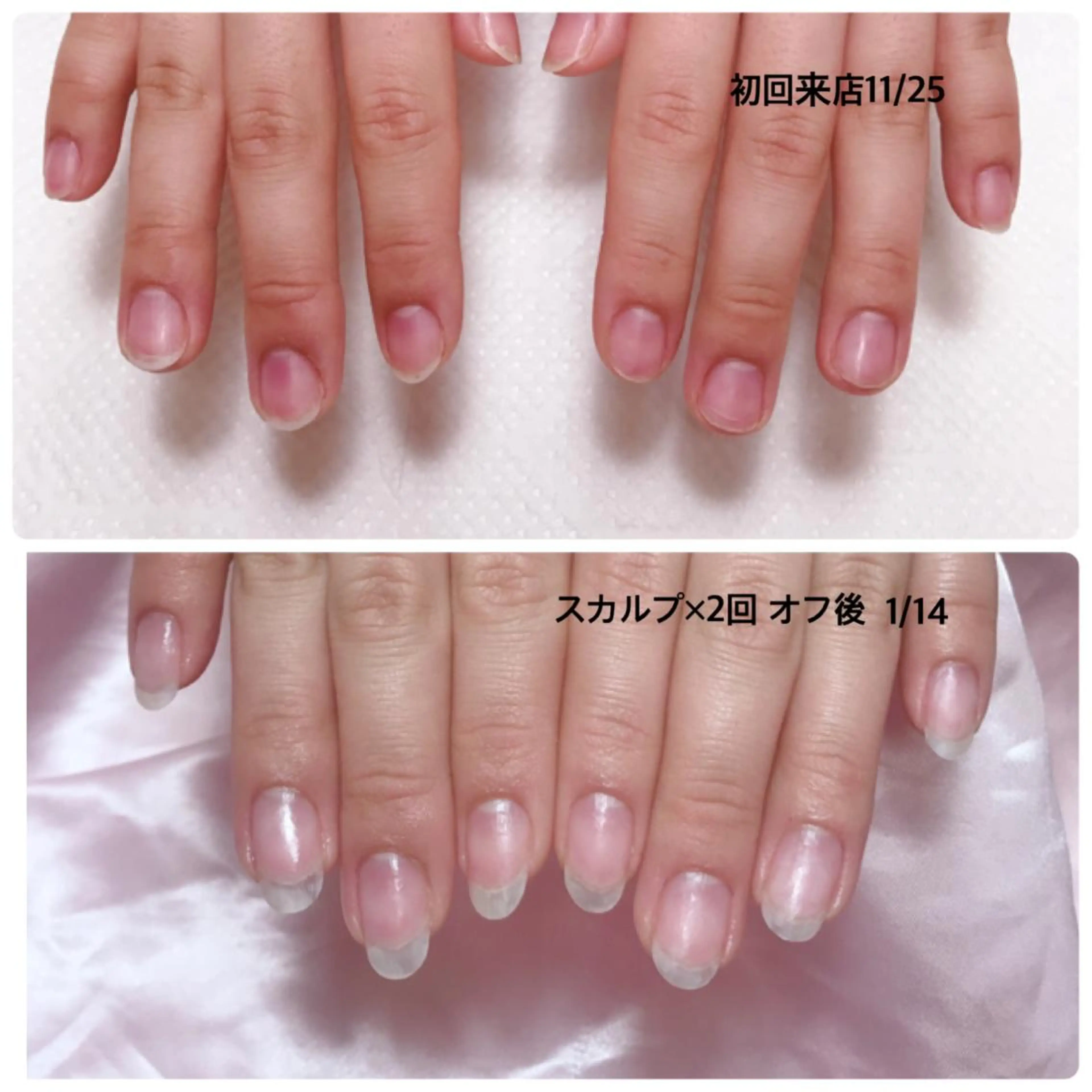ネイル スカルプネイル ハンドネイル 深爪を断らない スカルプ高評価店のネイルデザイン