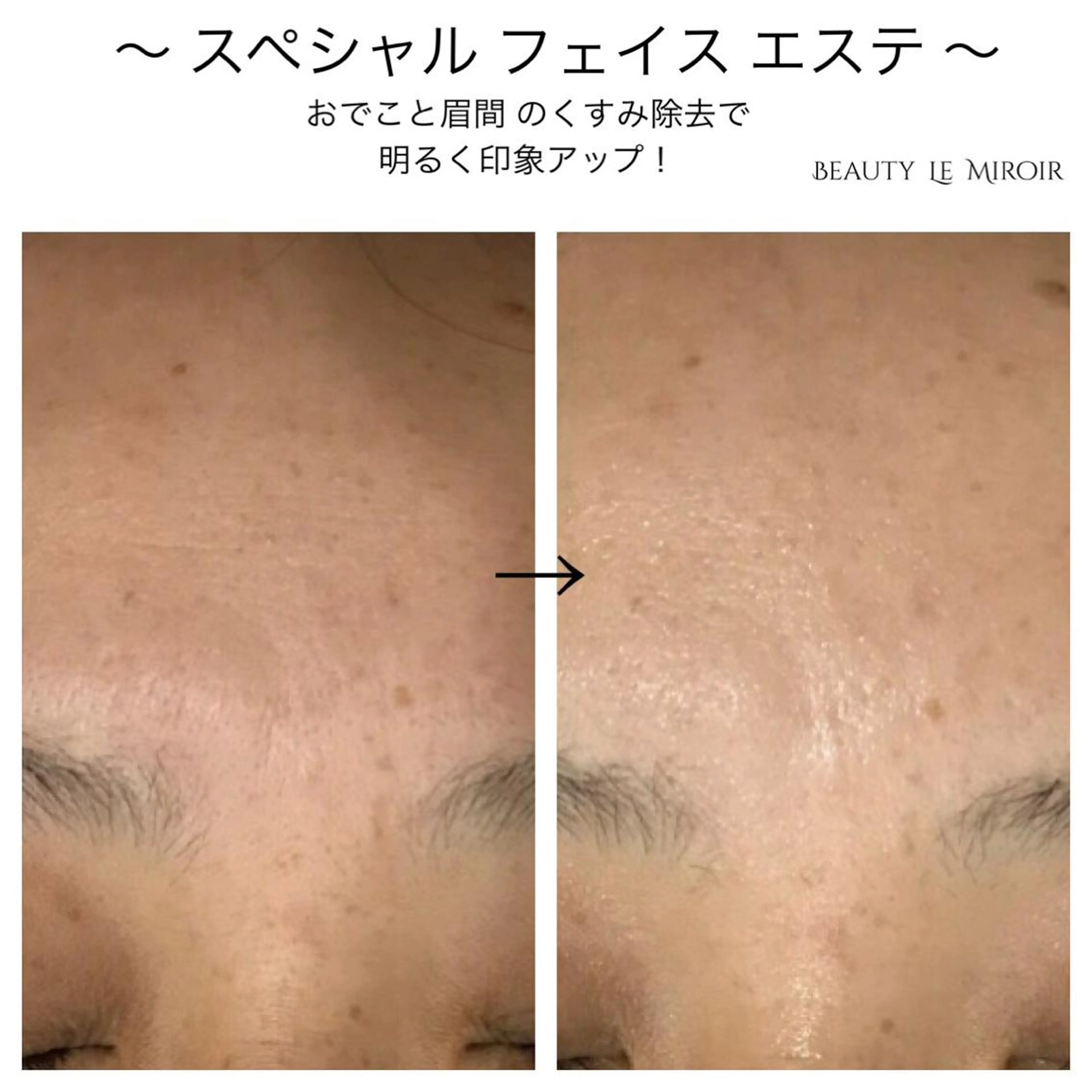 ビューティー ミロワールのエステ・リラクイメージ