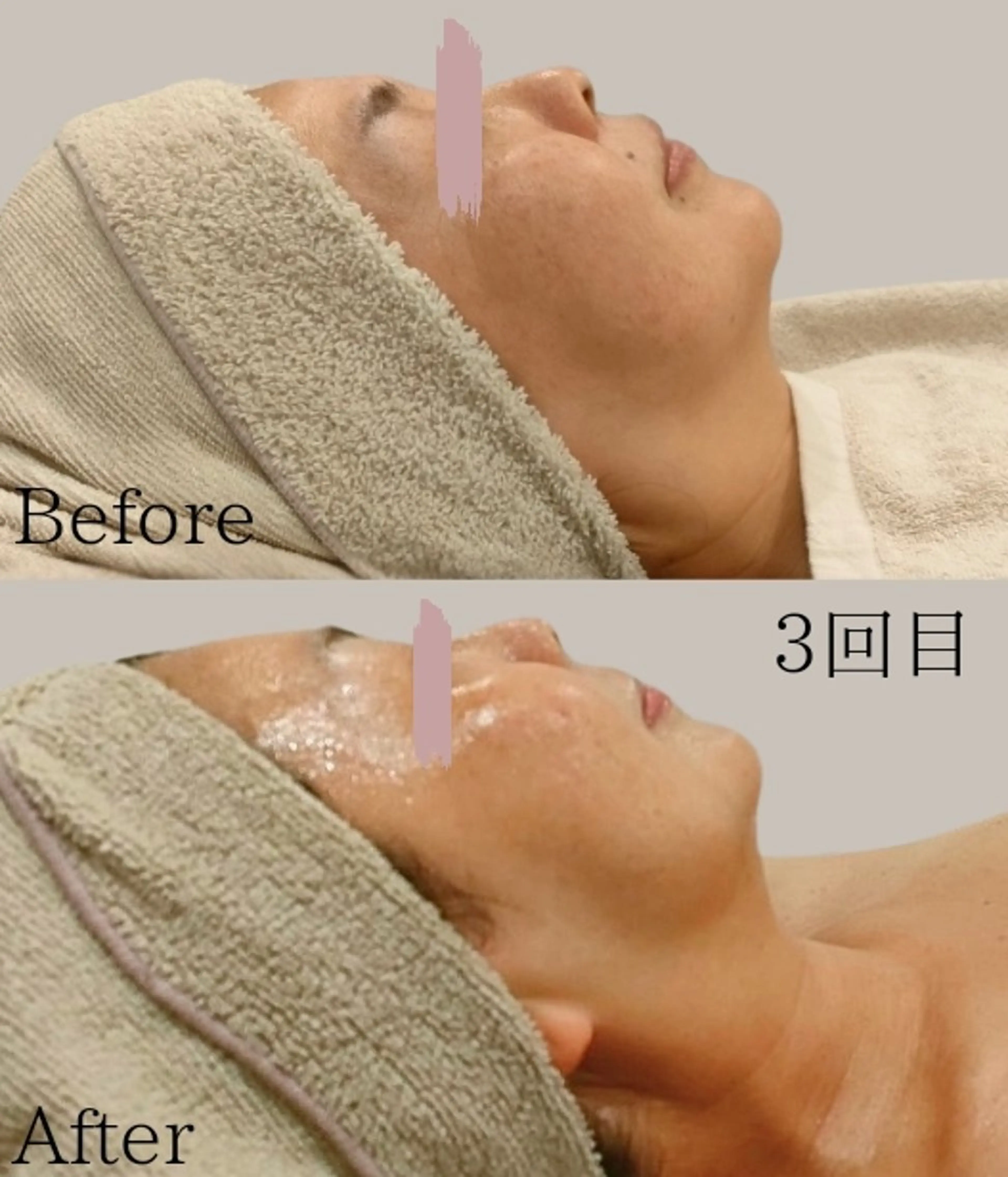 美肌脱毛＆小顔・フェ イシャル【SONA】のエステ・リラクイメージ