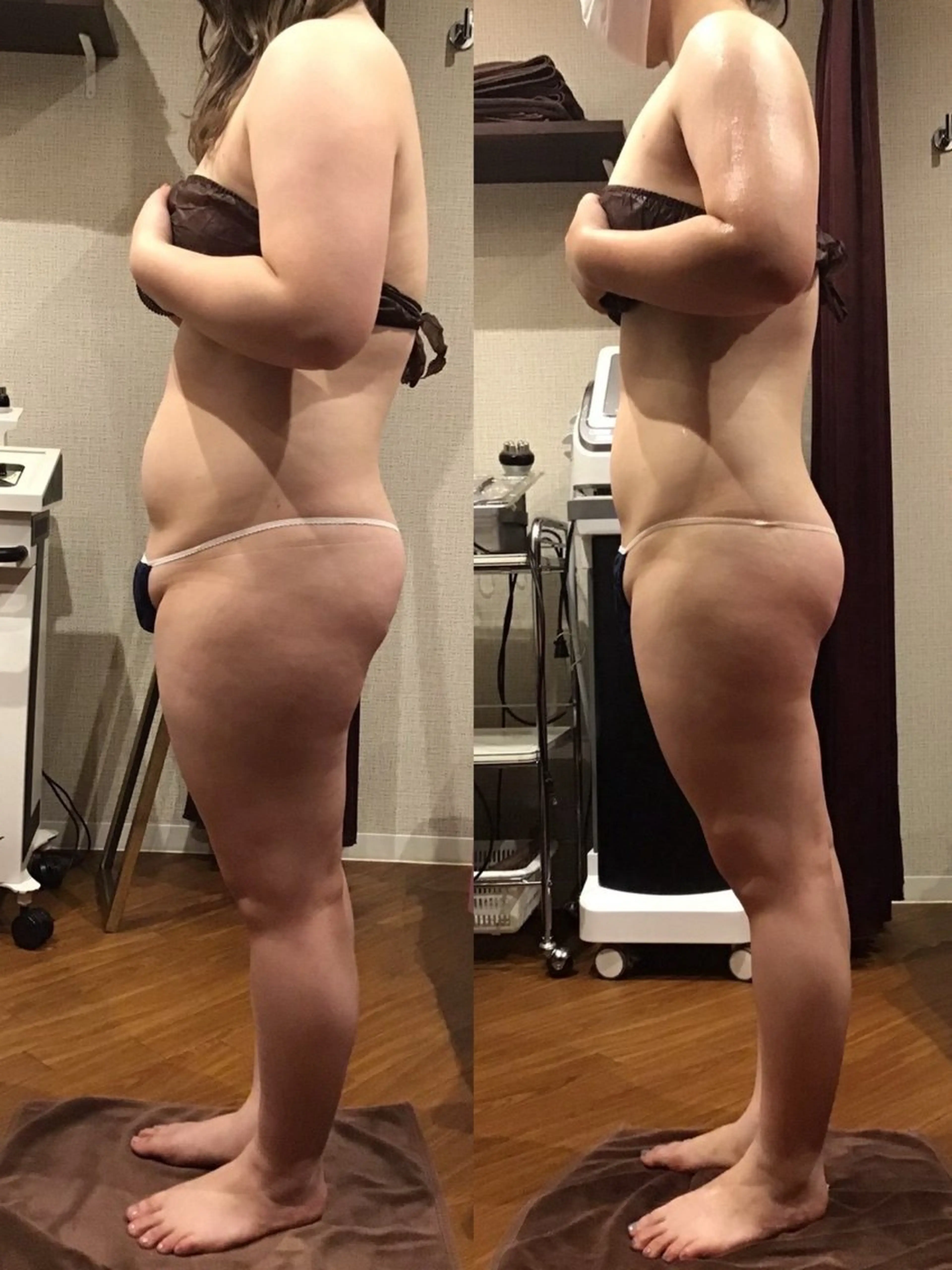 エステ リラク espresso,所属・《痩身、小顔専門店》 エスプレッソのエステ・リラクイメージ