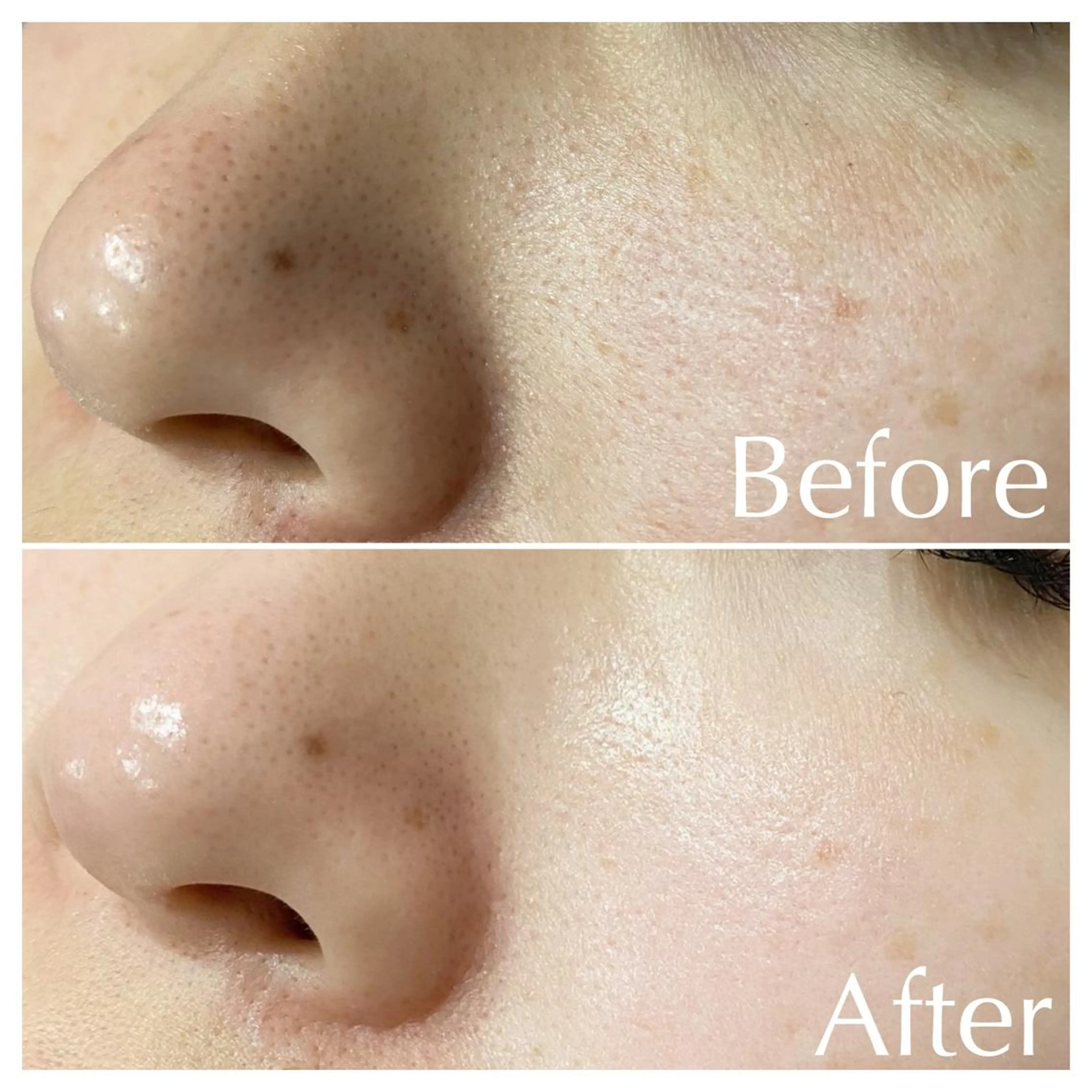 エステ ピーリング×肌管理 THREETHREEのエステ・リラクイメージ