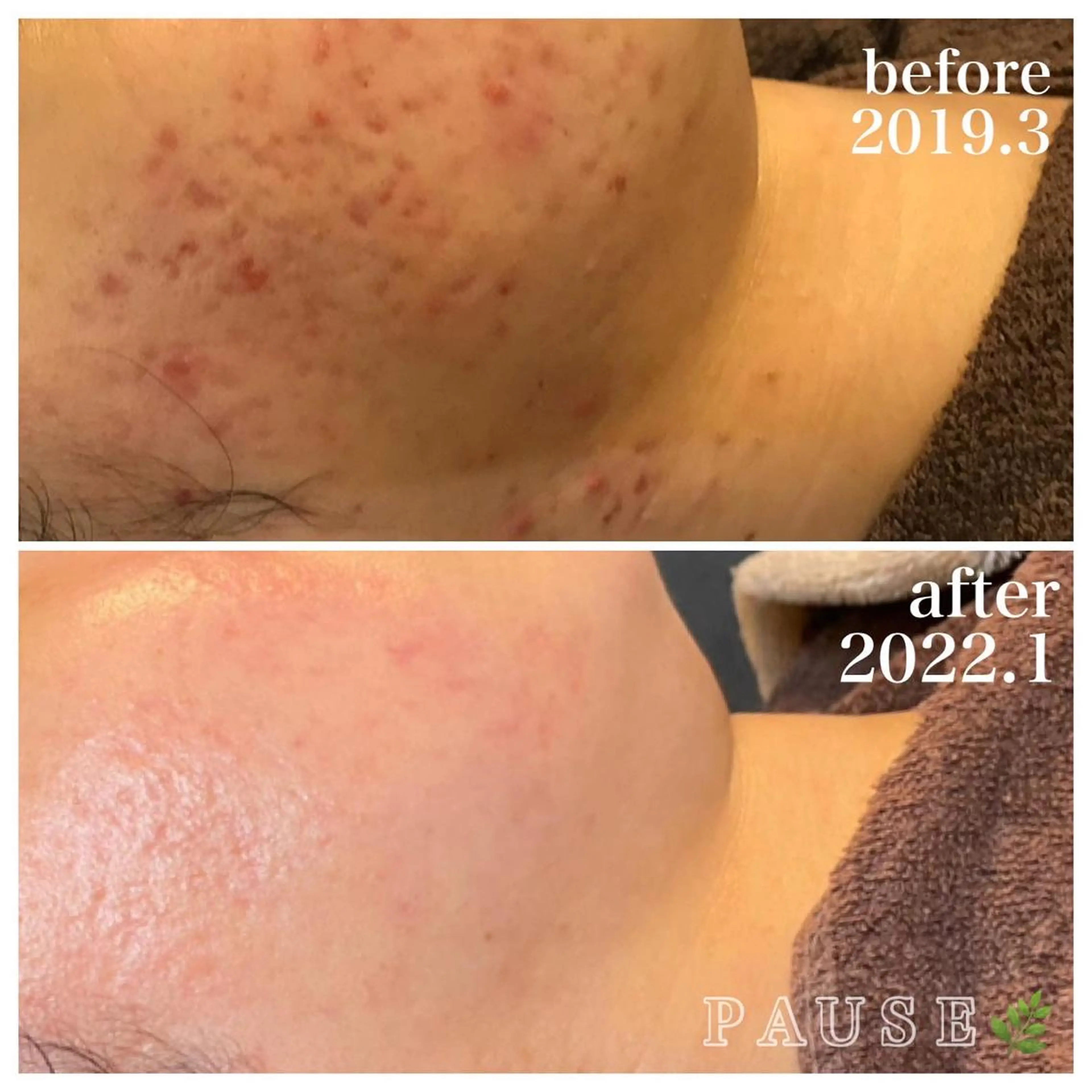 エステ 浜野 恵美のエステ・リラクイメージ