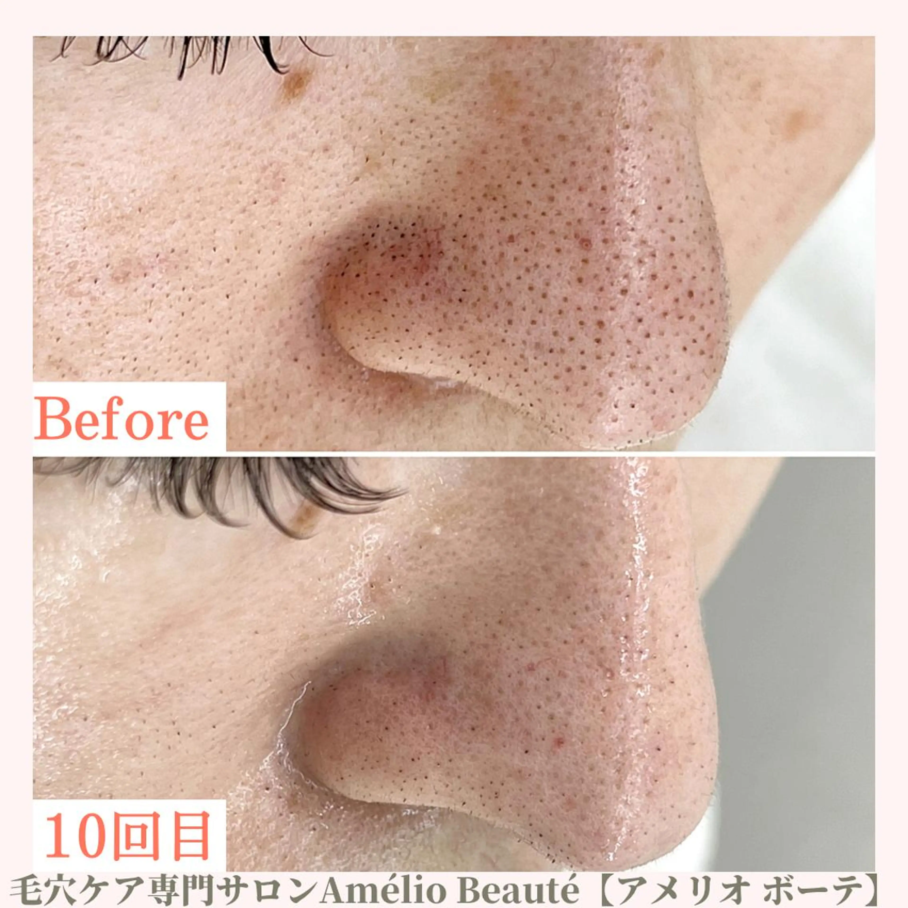 毛穴ケア専門サロン Amélio Beauté所属・毛穴ケア専門サロン アメリオボーテのその他イメージ