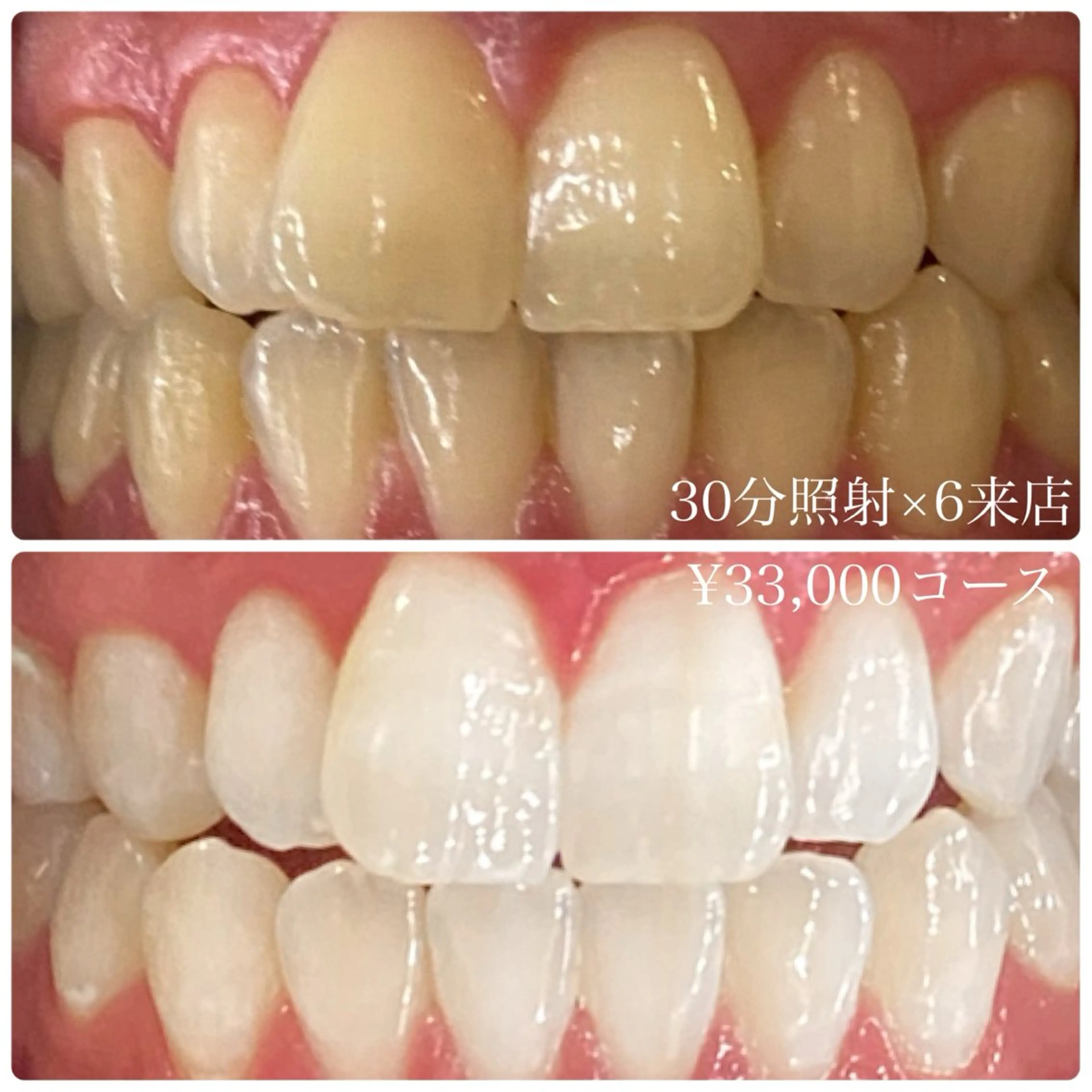 メンズ その他 ホワイトニングルーム　川崎店所属・ホワイトニング ルーム　川崎店のその他イメージ