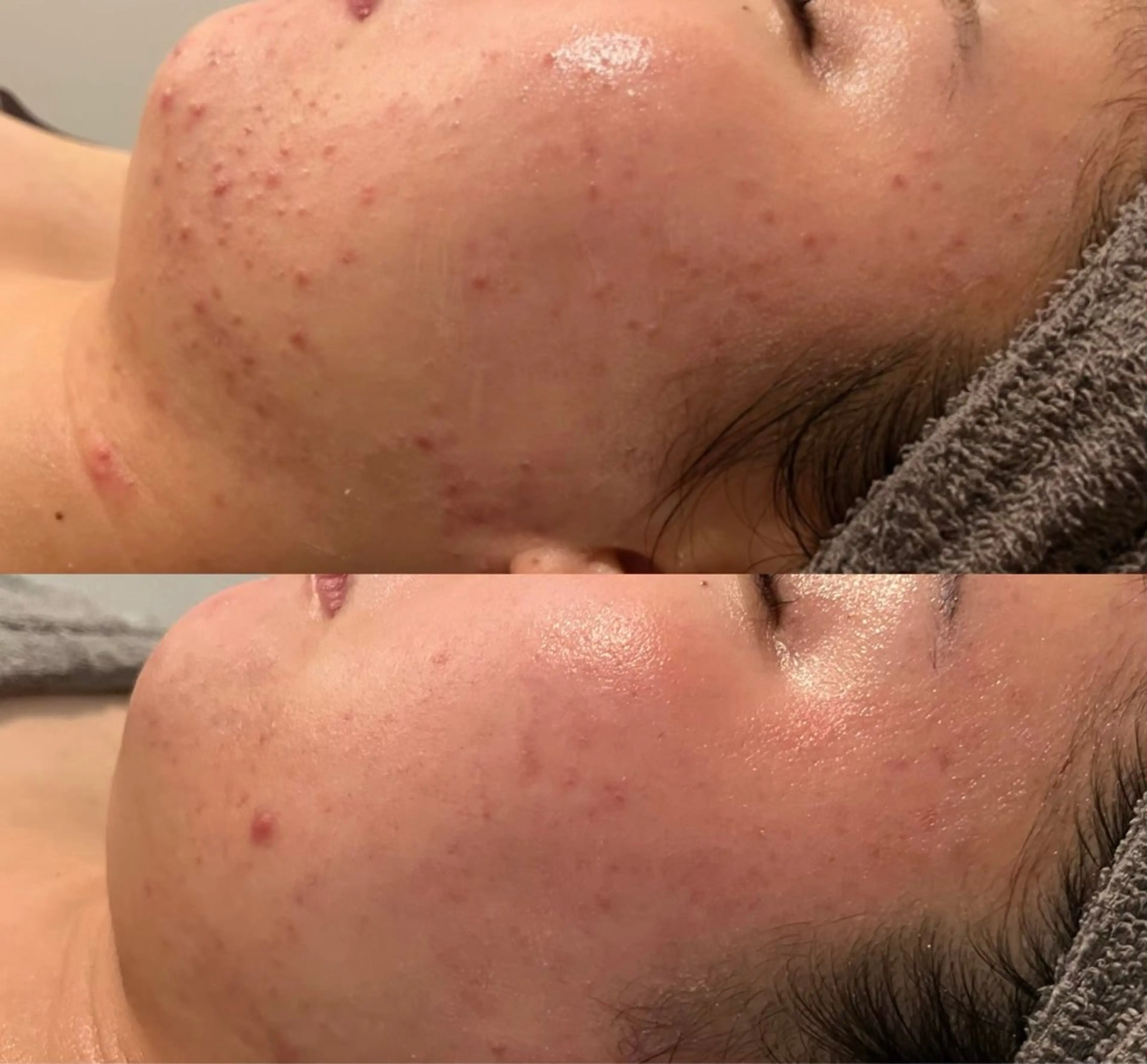 Butterfly 平塚店 佐藤のエステ・リラクイメージ