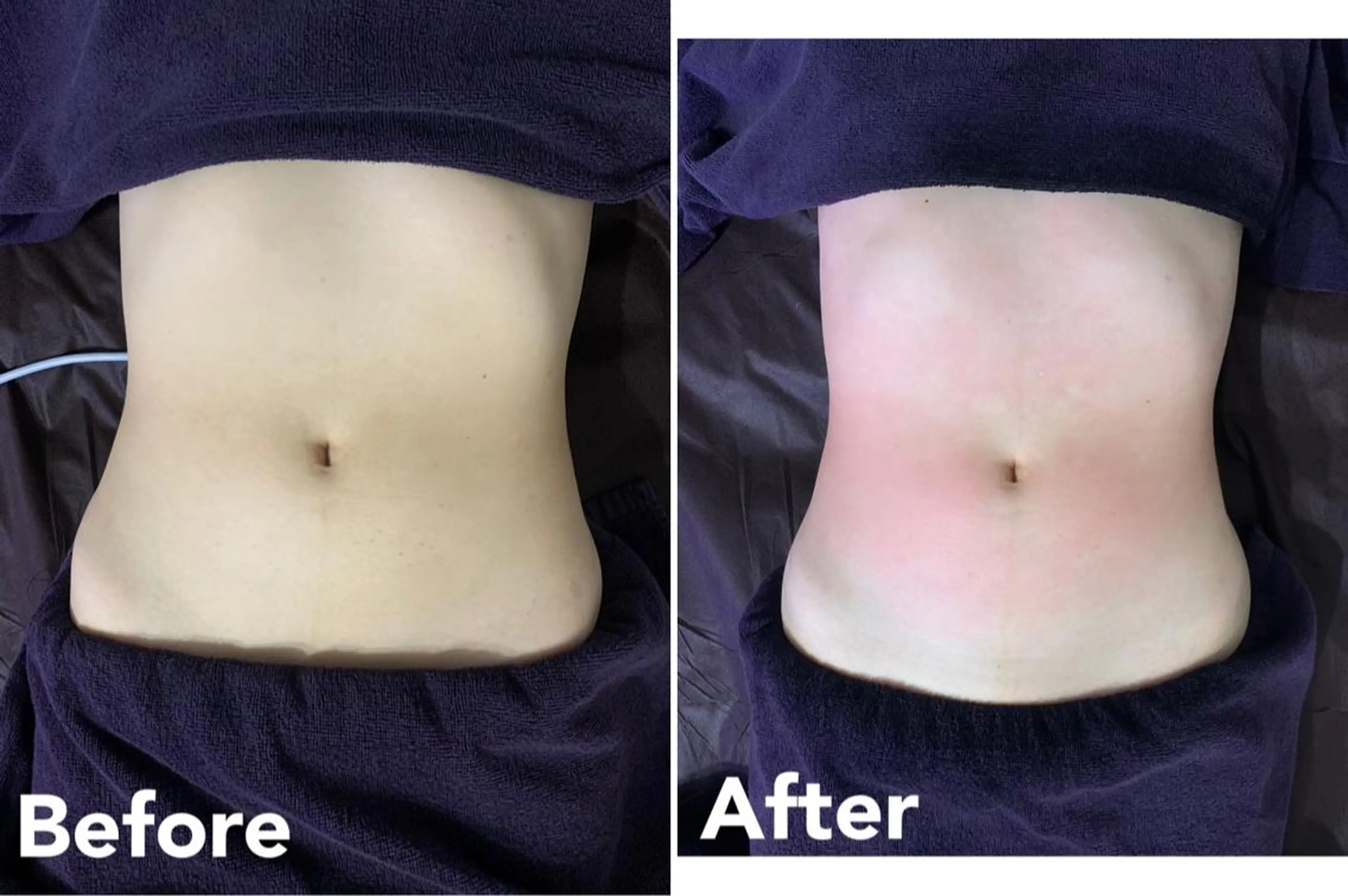 SESUNNY セサニー SEIRAのマツエク・マツパデザイン