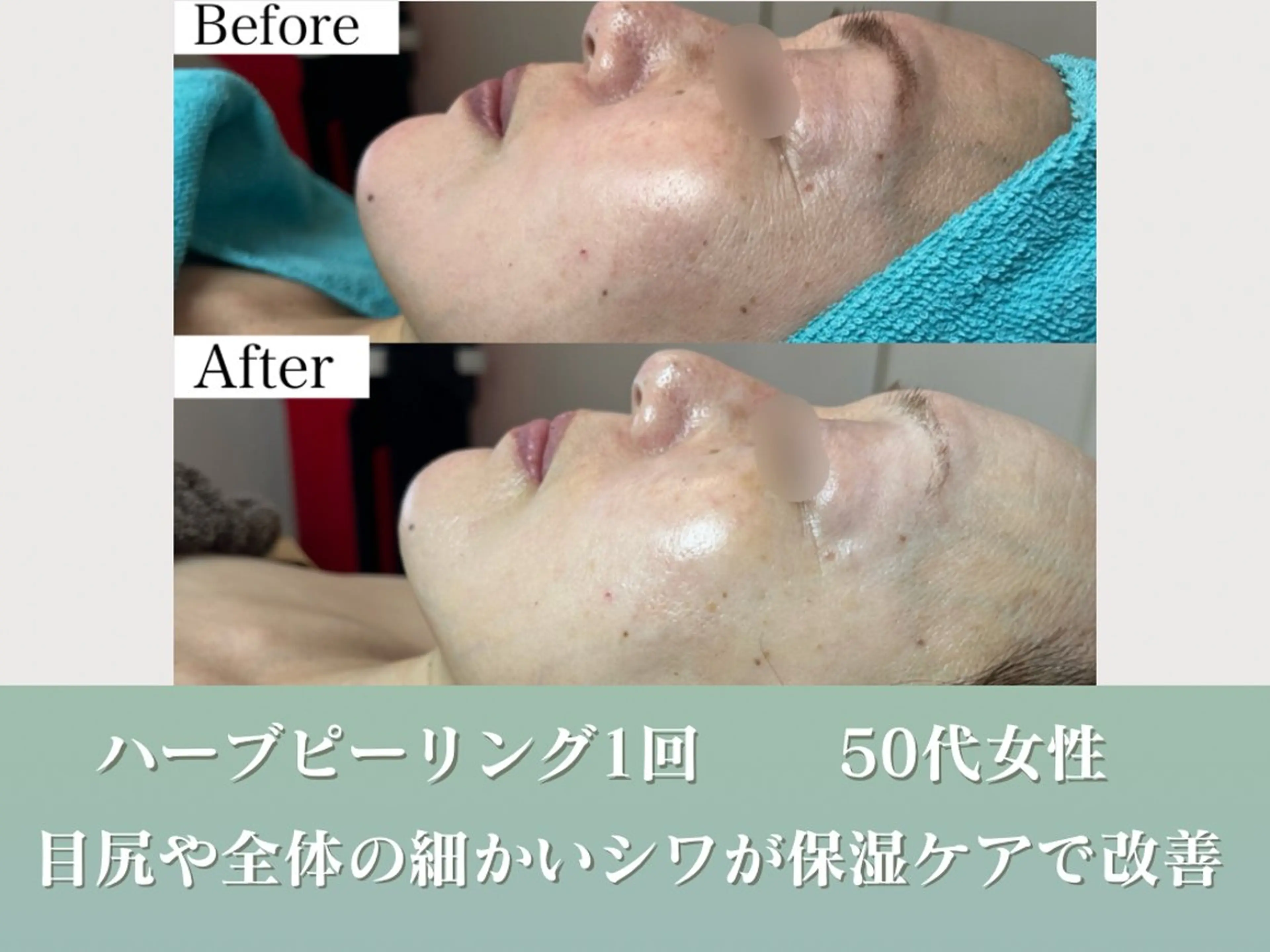 潤い艶肌／肌質改善 YUKAのエステ・リラクイメージ