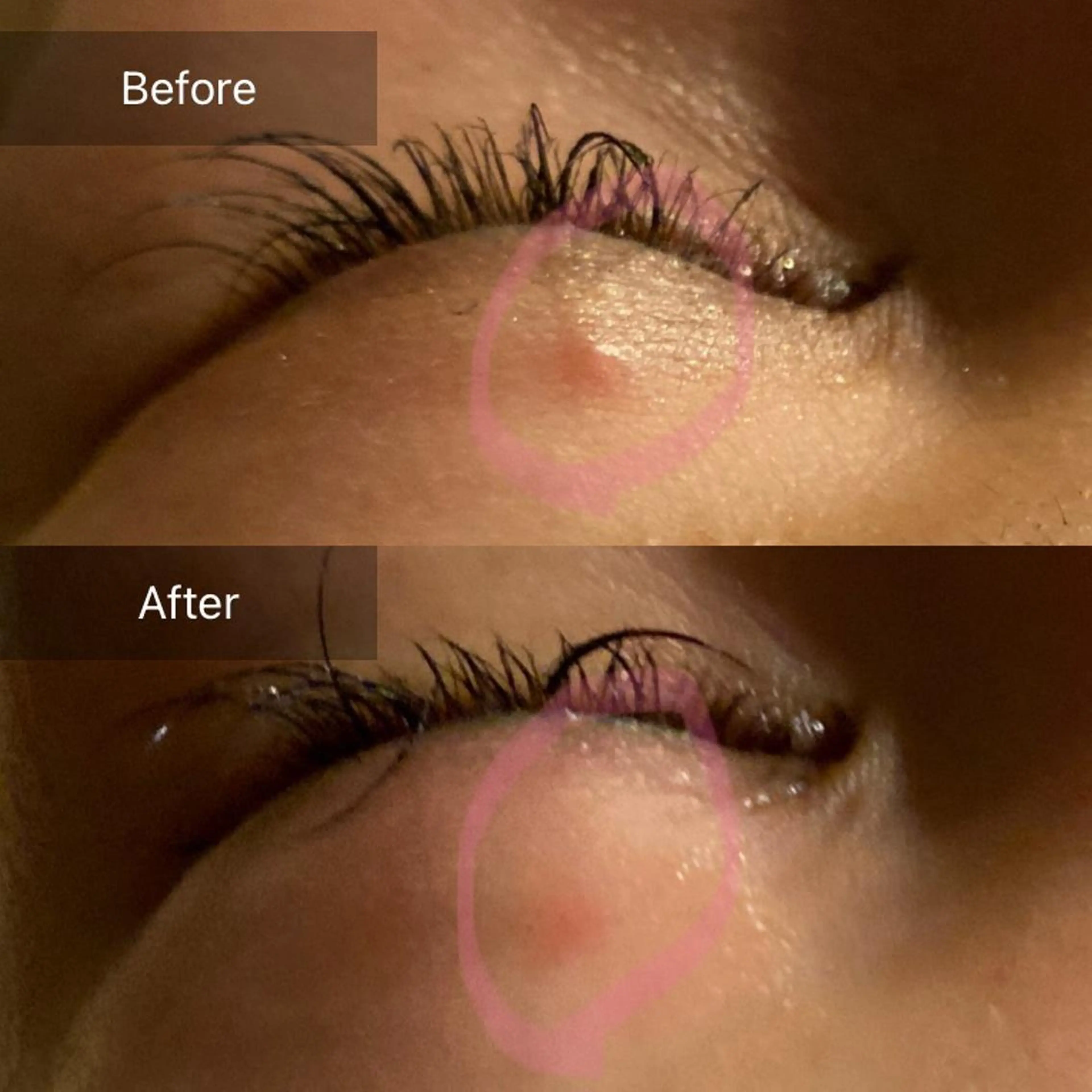 Mandarin Orange所属・毛穴から始める肌メン テマンダリンオレンジのエステ・リラクイメージ