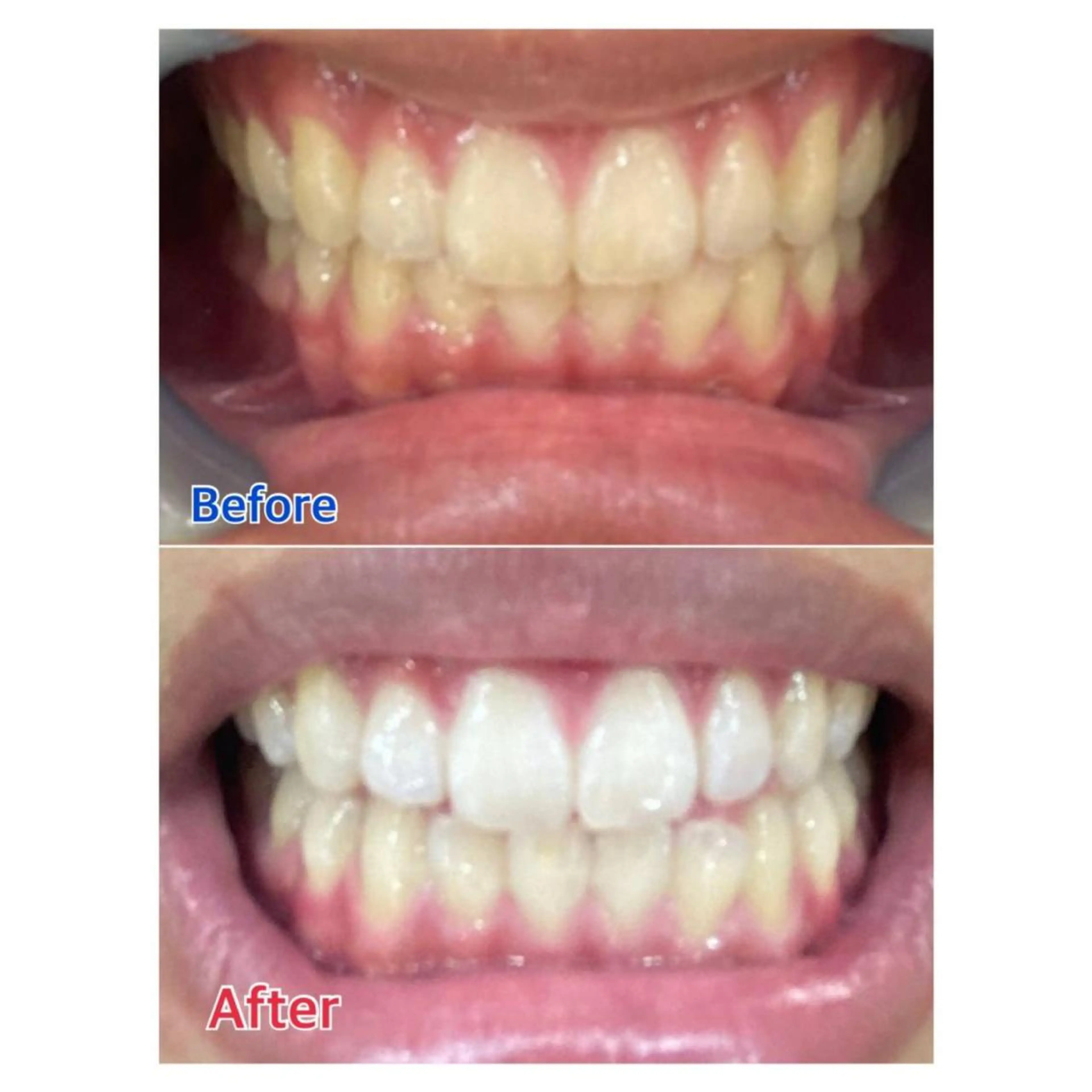 MBEAUTYSALON 千葉店・京成大久保所属・Melty 輝のその他イメージ