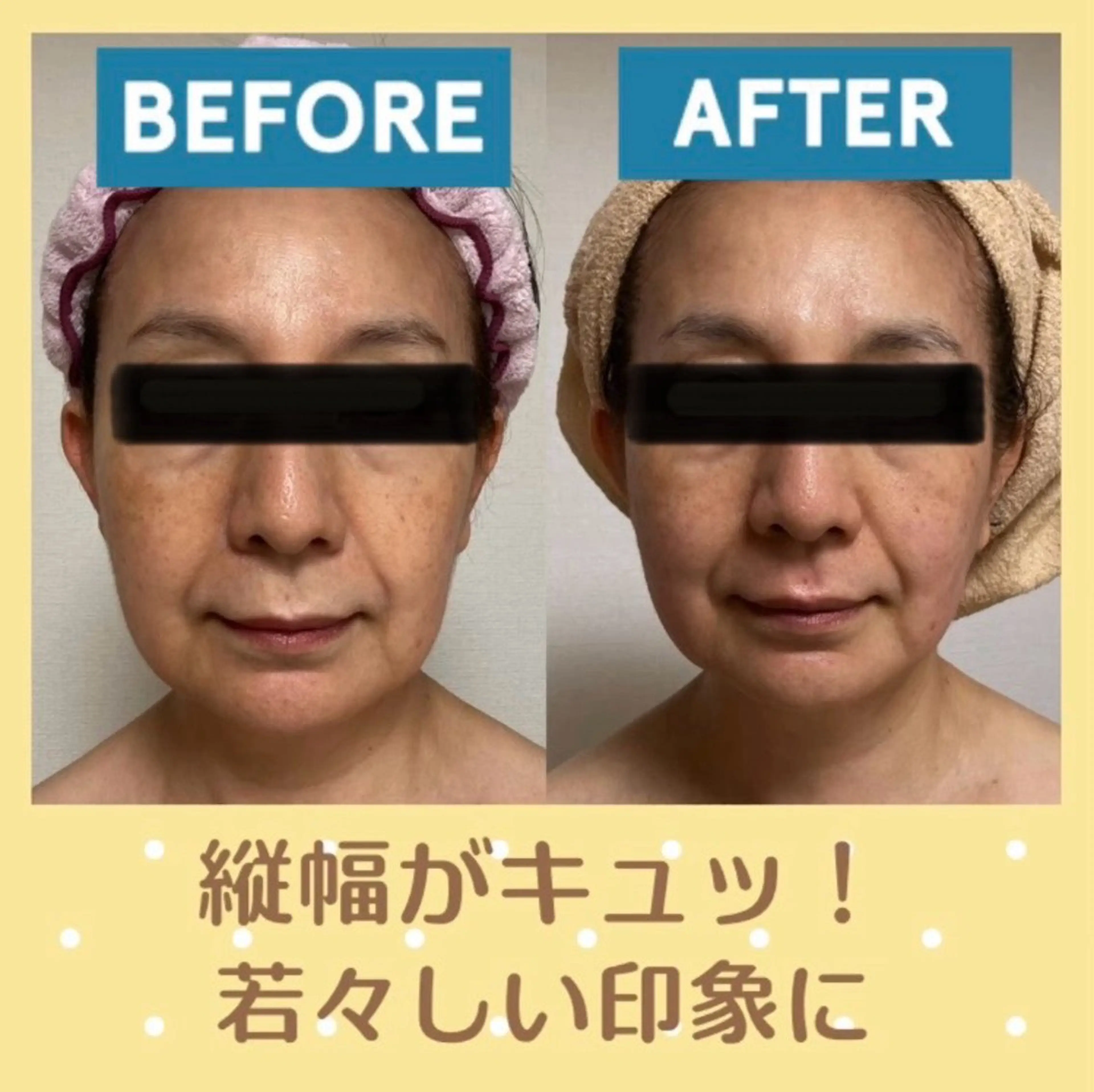 小顔矯正サロン プルメリアのエステ・リラクイメージ