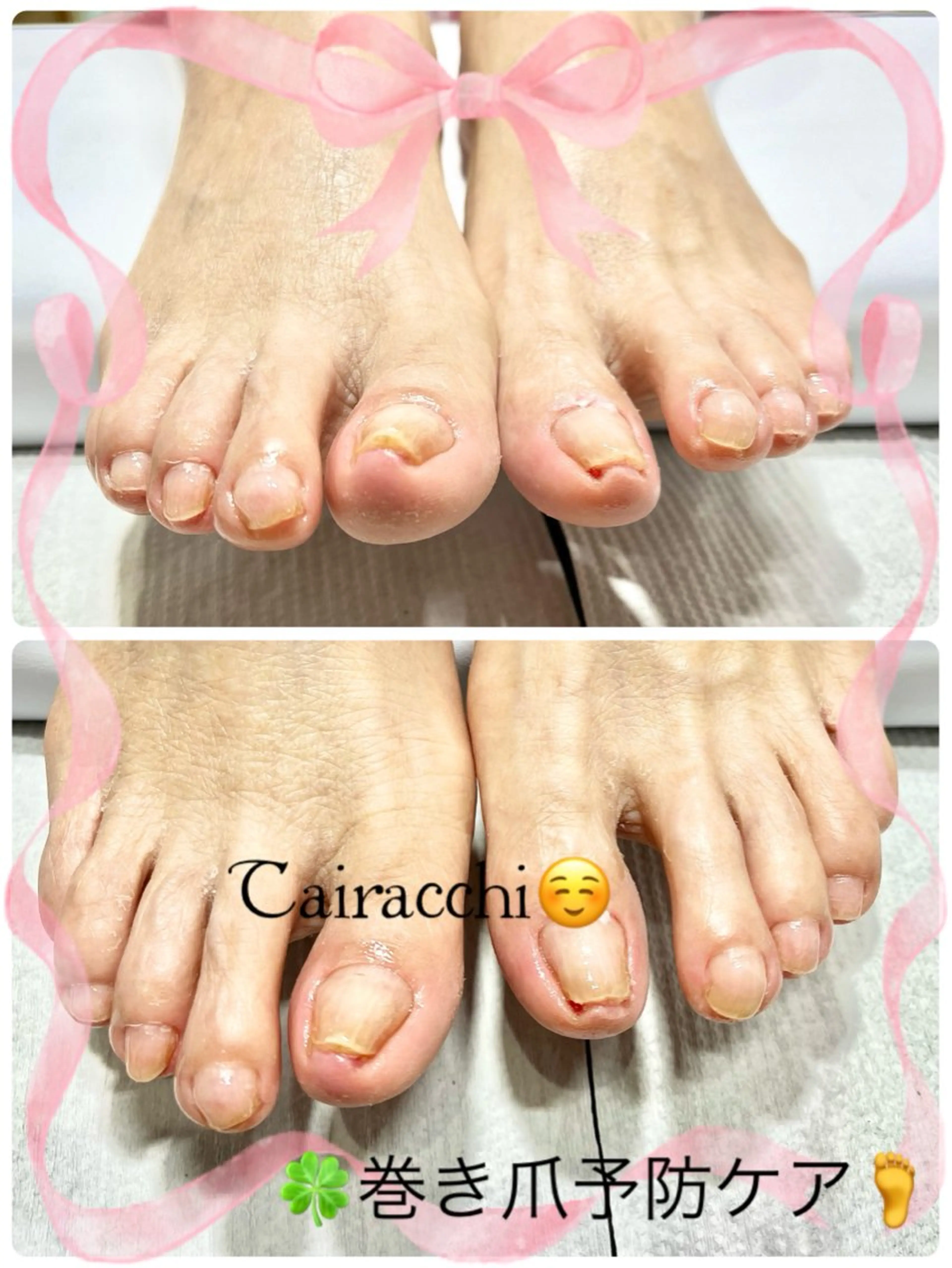 ネイル キラキラネイル フットネイル Tairacchi ﾀｲﾗｯﾁのエステ・リラクイメージ