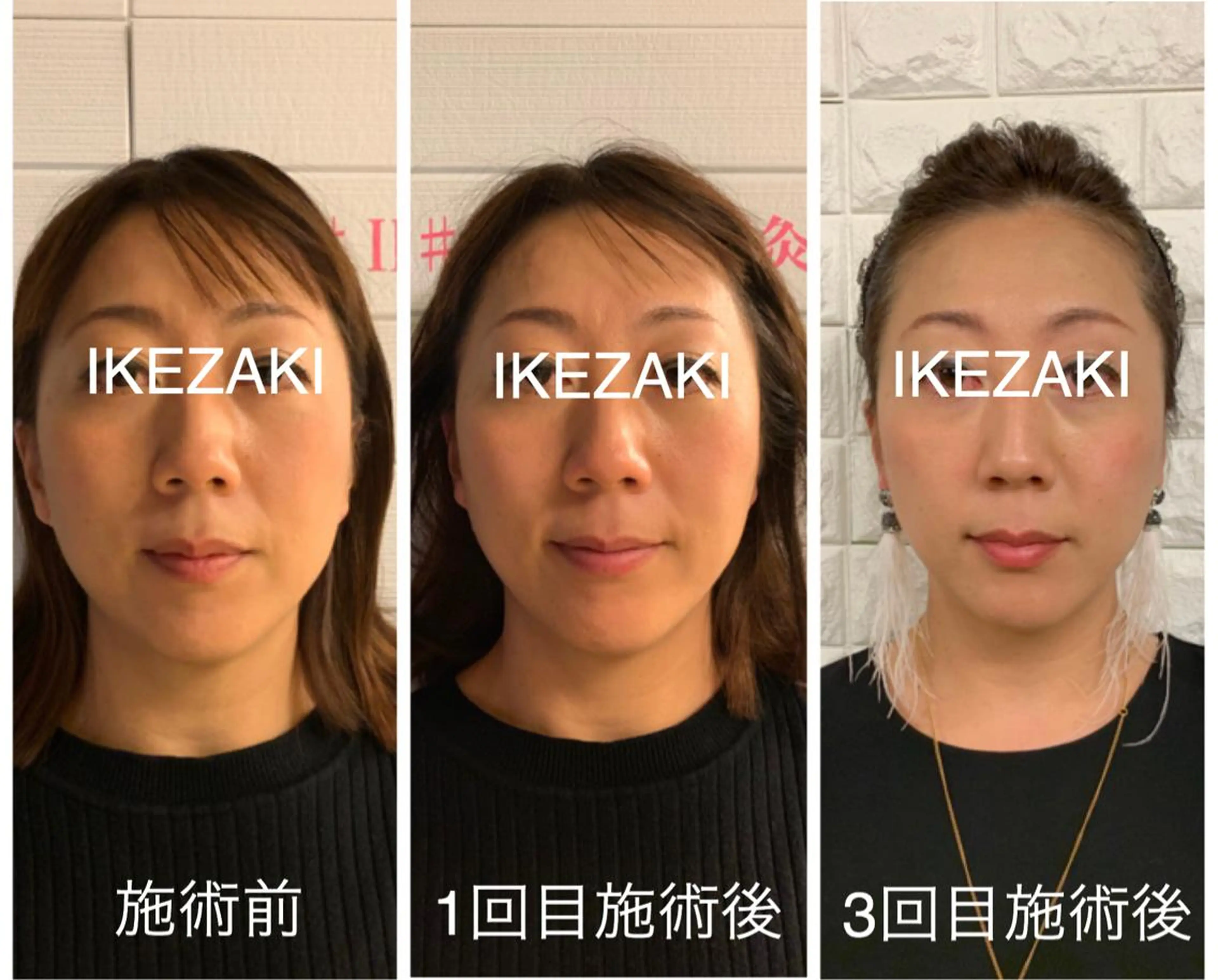 美容鍼 IKEZAKIのエステ・リラクイメージ