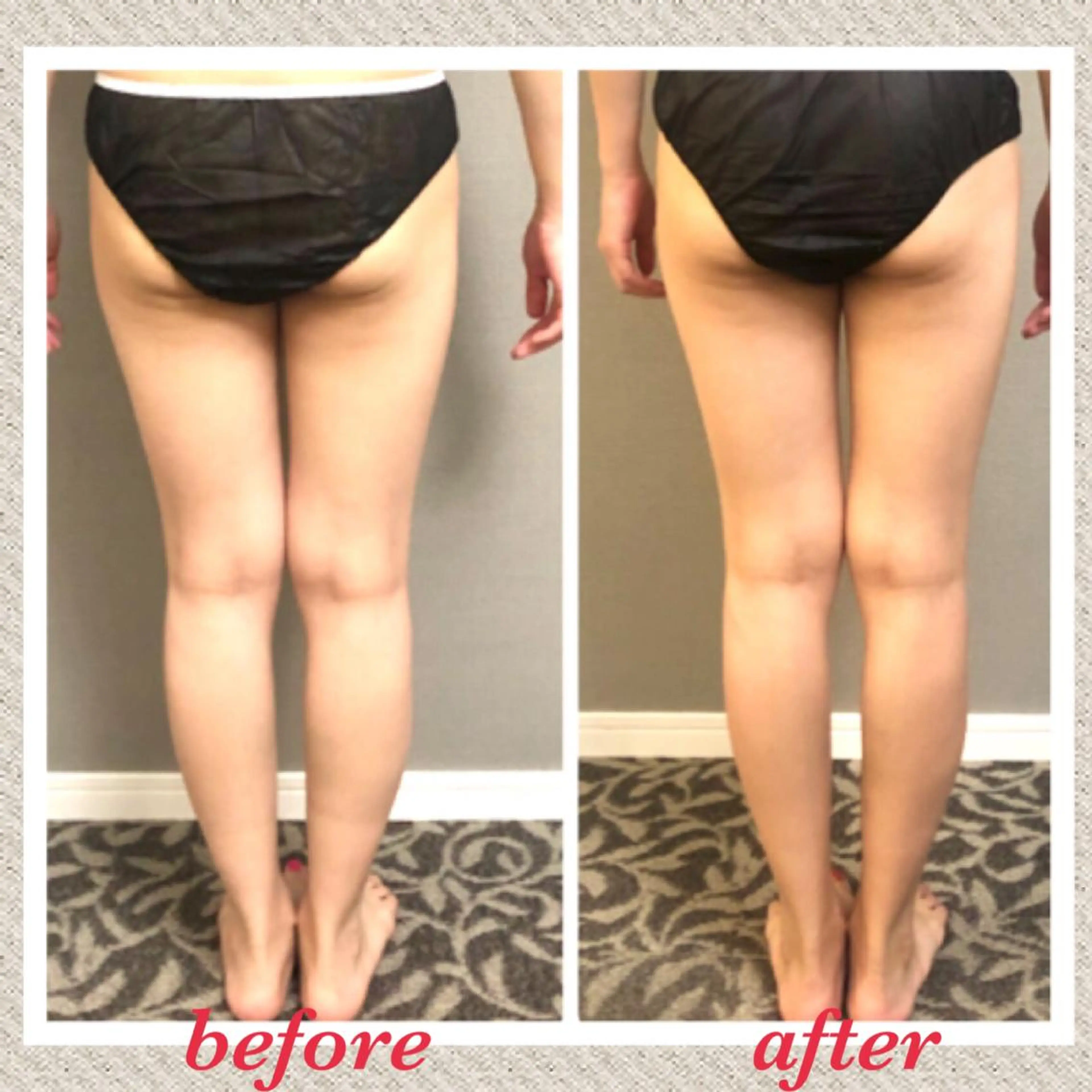 エステ リラク 美ola ビオラのエステ・リラクイメージ