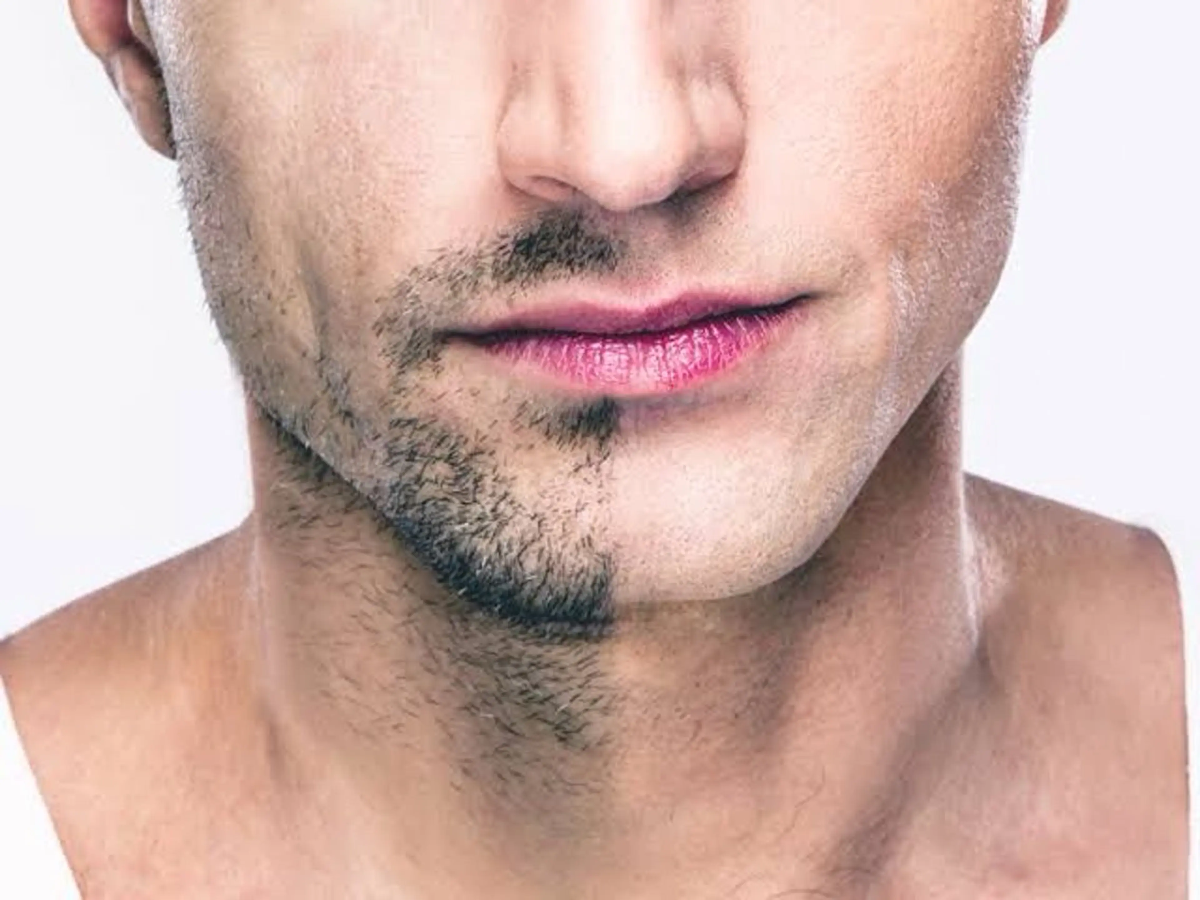 ＼✨️今だけ!!特別価格✨️／men'sヒゲ脱毛パーツ1ヶ所【おでこ、頬、鼻下、あご、もみあげ、首(顎下)⠀】の写真