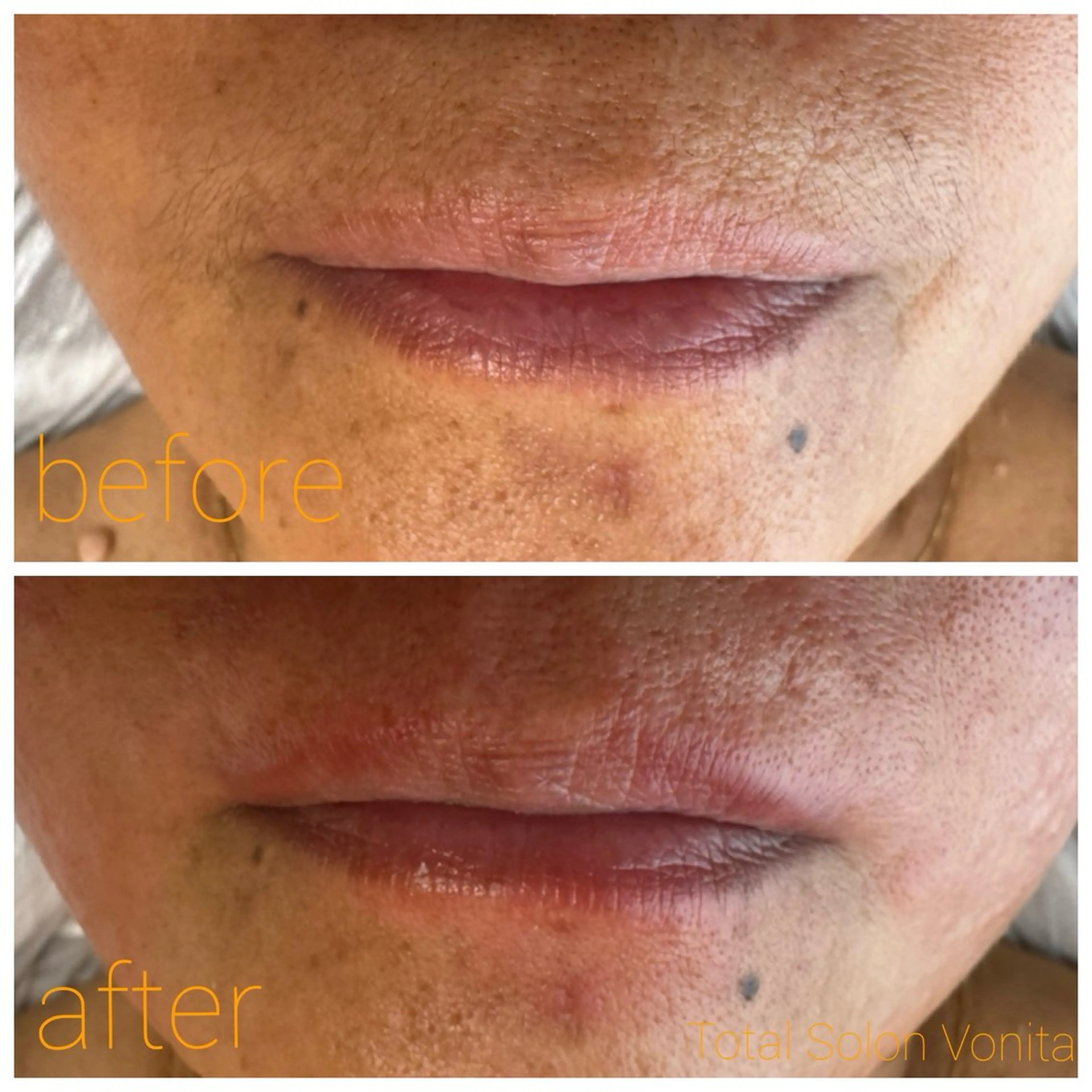 Vonita Aiのエステ・リラクイメージ