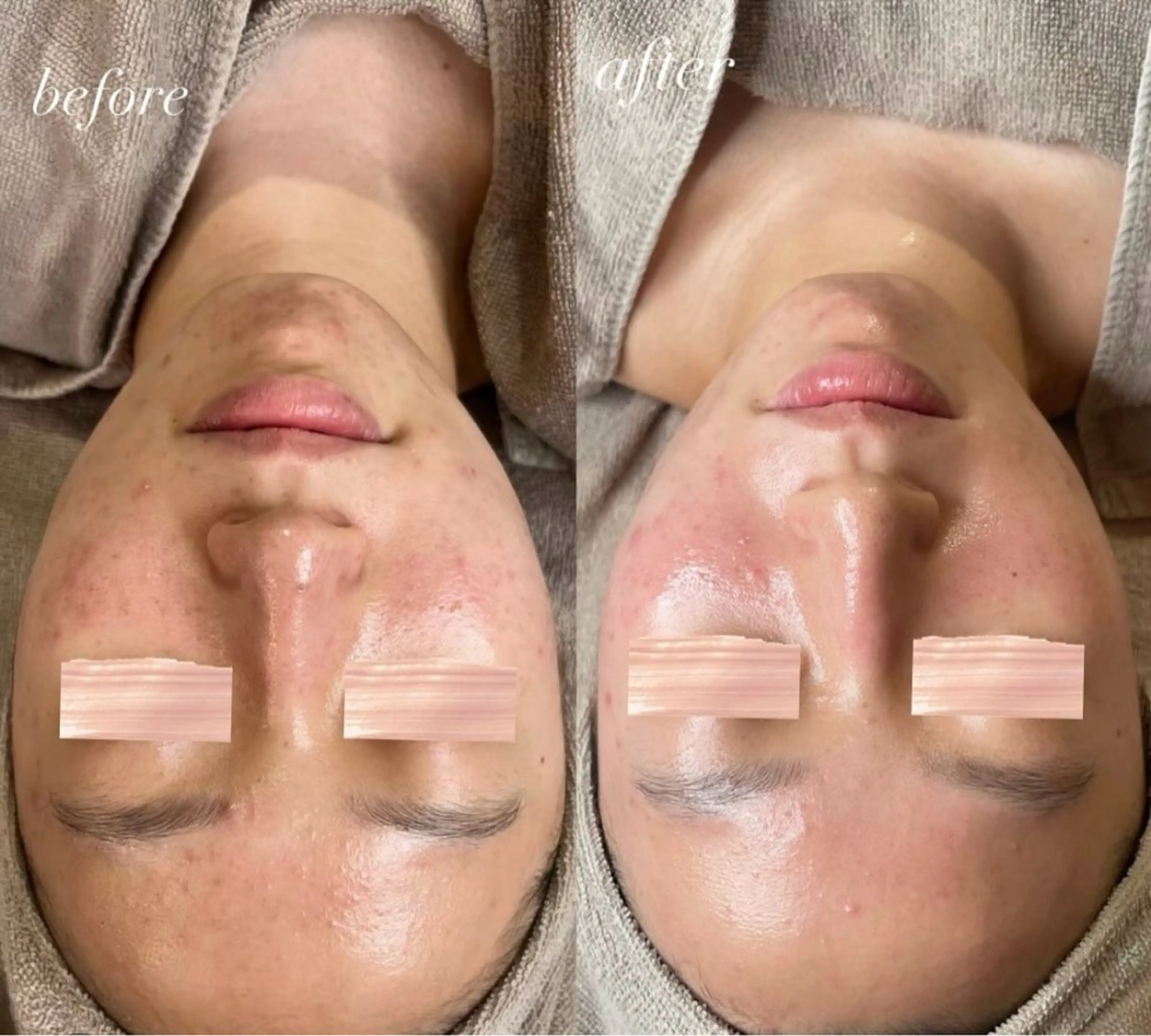 エステ 山下 綾乃のエステ・リラクイメージ