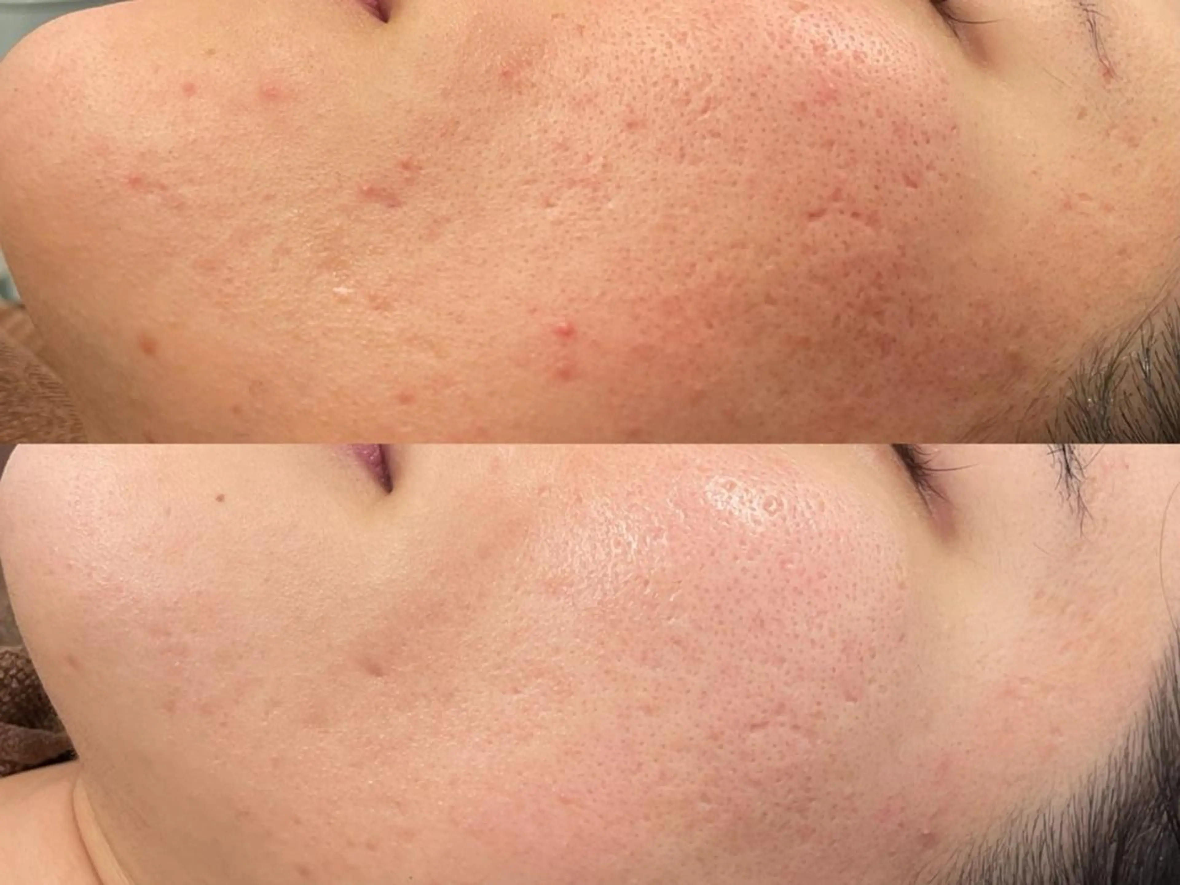 🌈fein.トータ ルビューティー🌈のマツエク・マツパデザイン