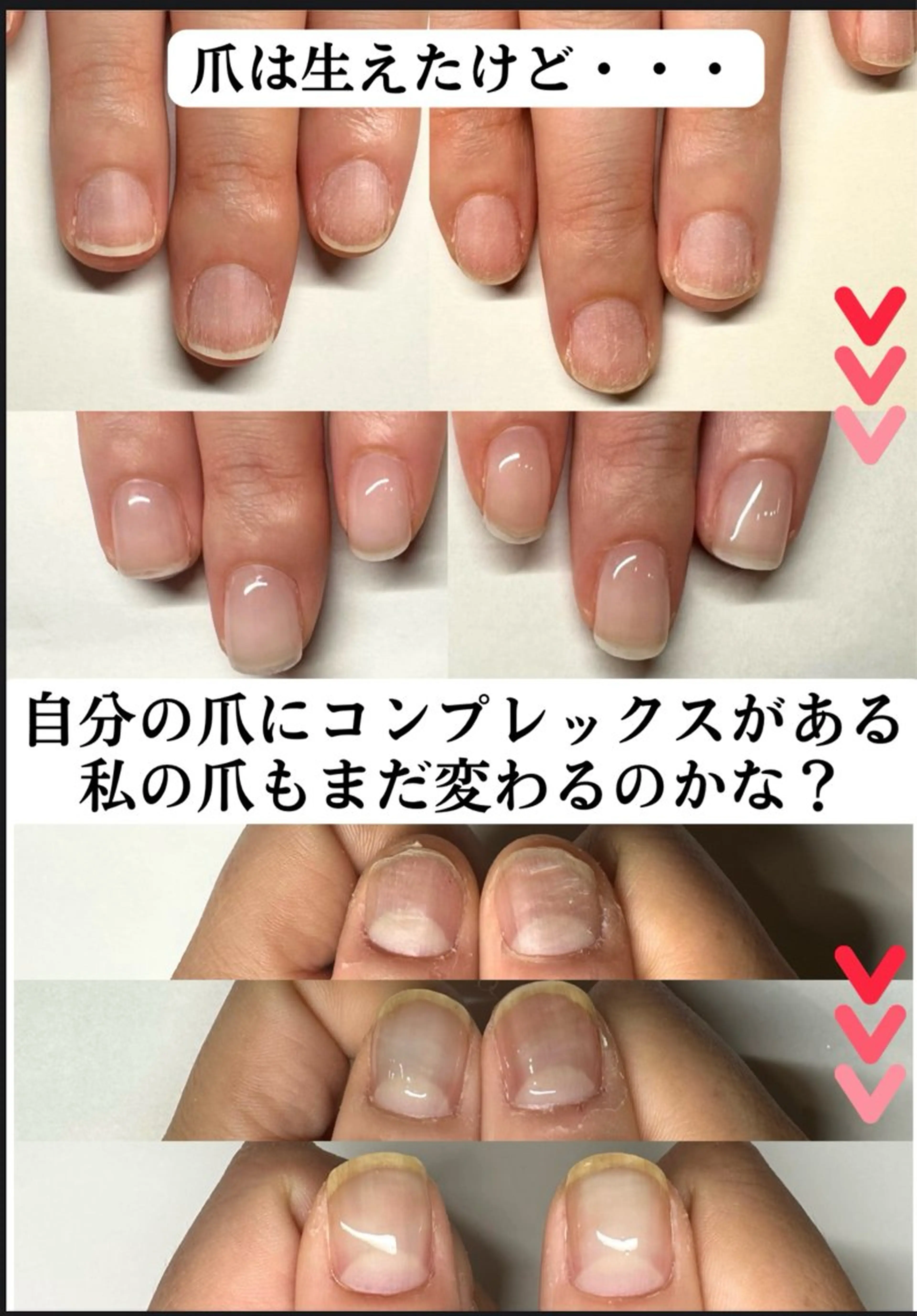 ネイル 深爪矯正専門店ネイルサロンKUU所属・ネイルサロン KUUのネイルデザイン