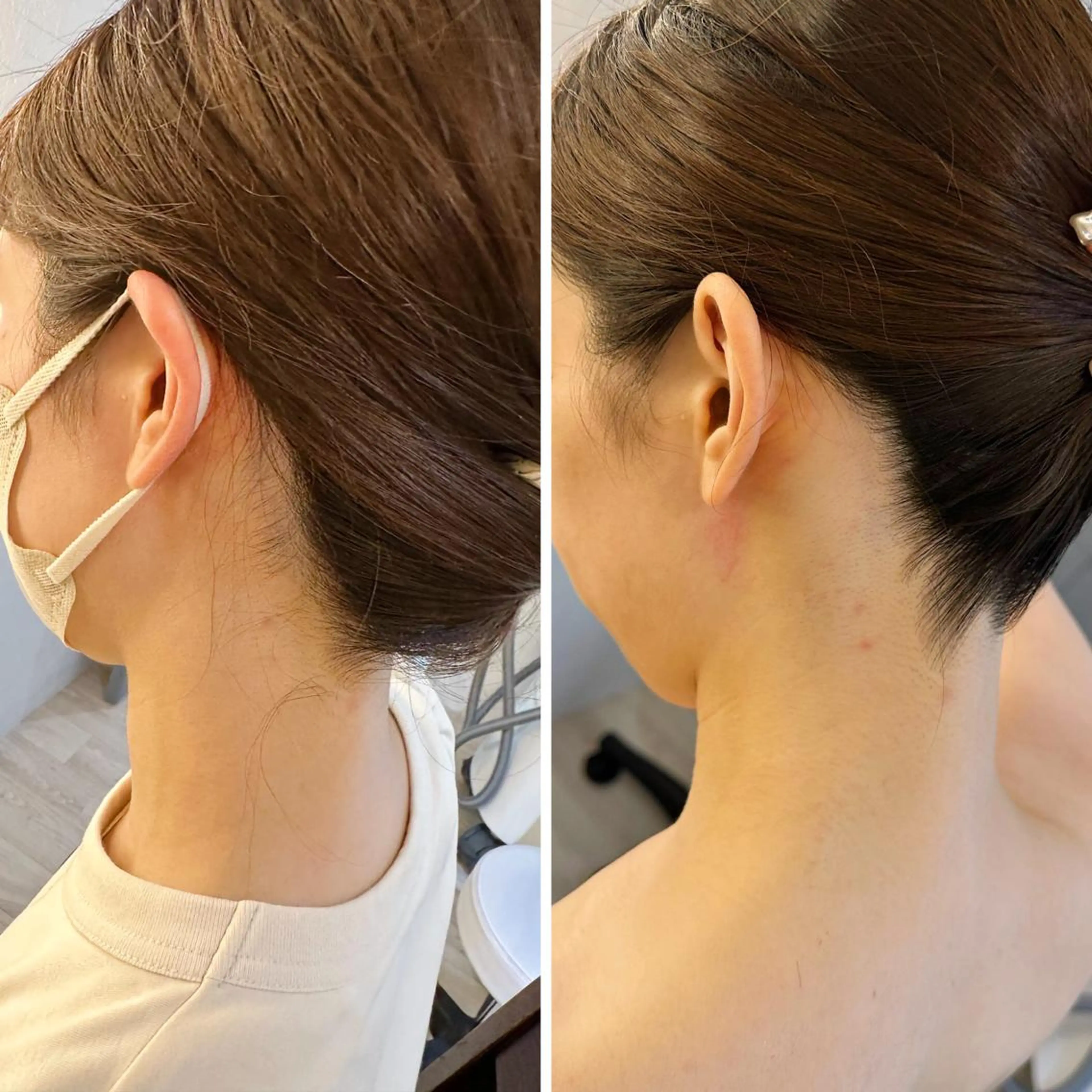 うなじ脱毛/美肌脱毛 LABELのエステ・リラクイメージ