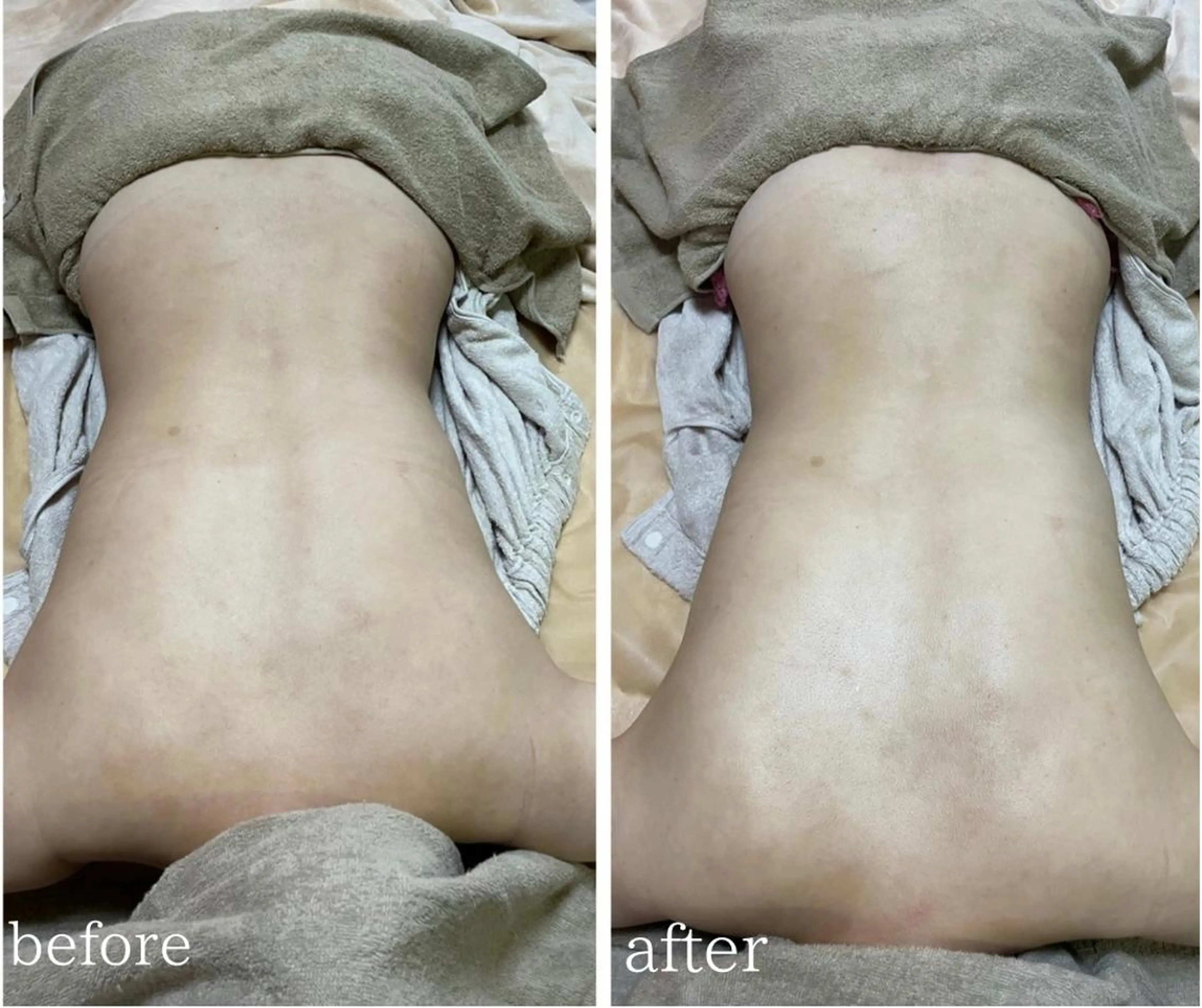 calimelo所属・calimero 美肌脱毛サロンの眉毛・アイブロウイメージ