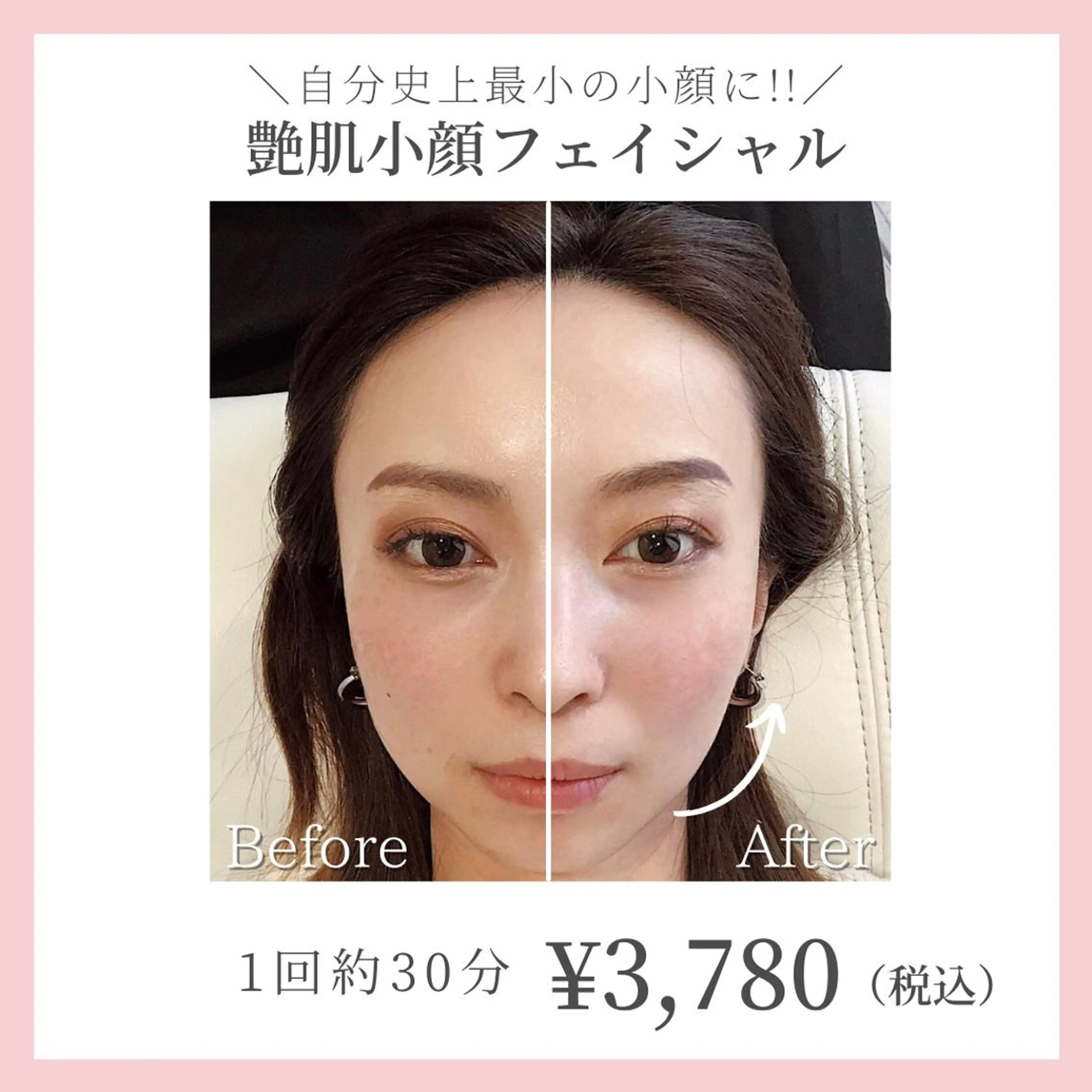 コガオファクトリー 北24条店のエステ・リラクイメージ