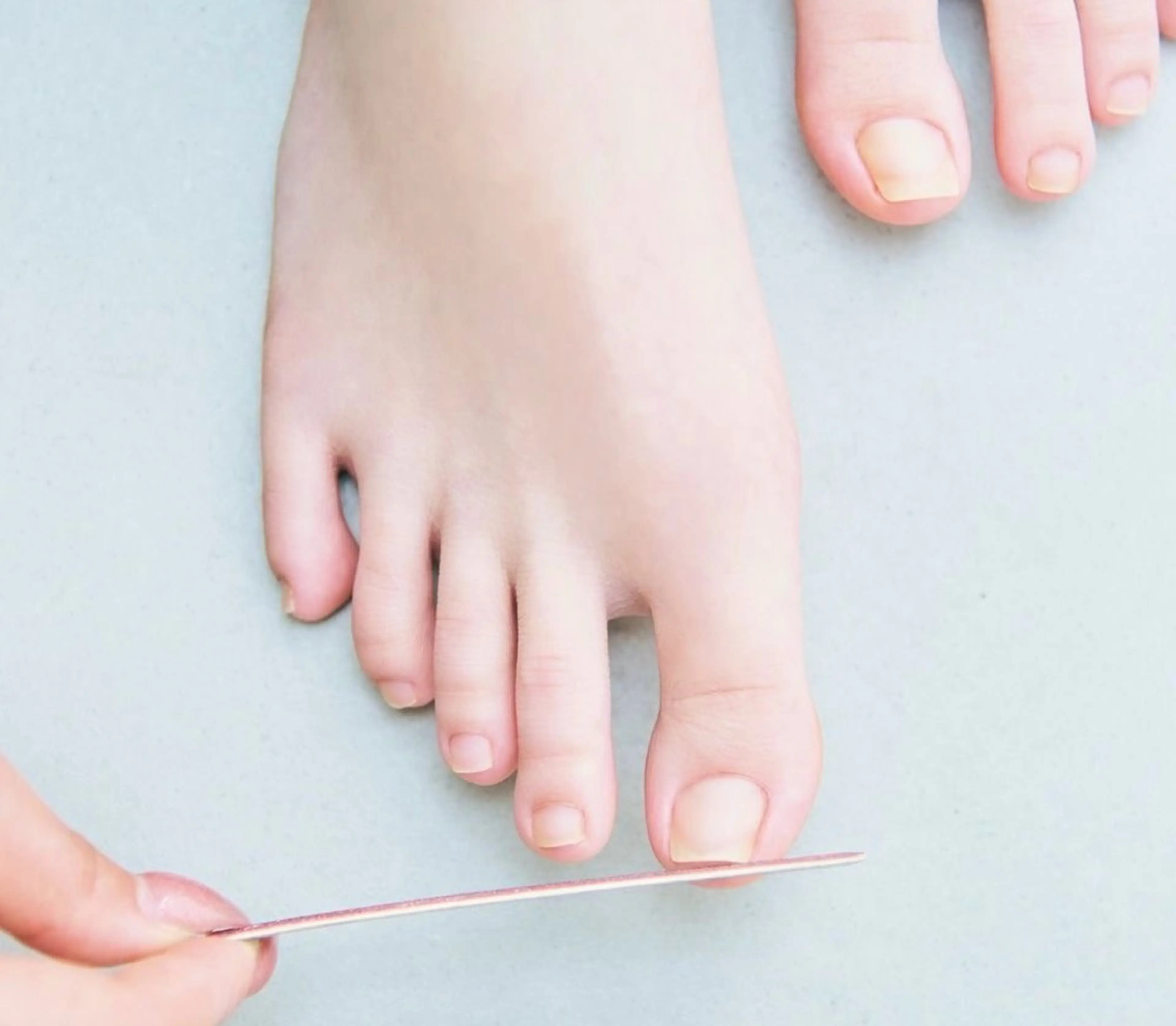 【Foot】自爪戻しの写真