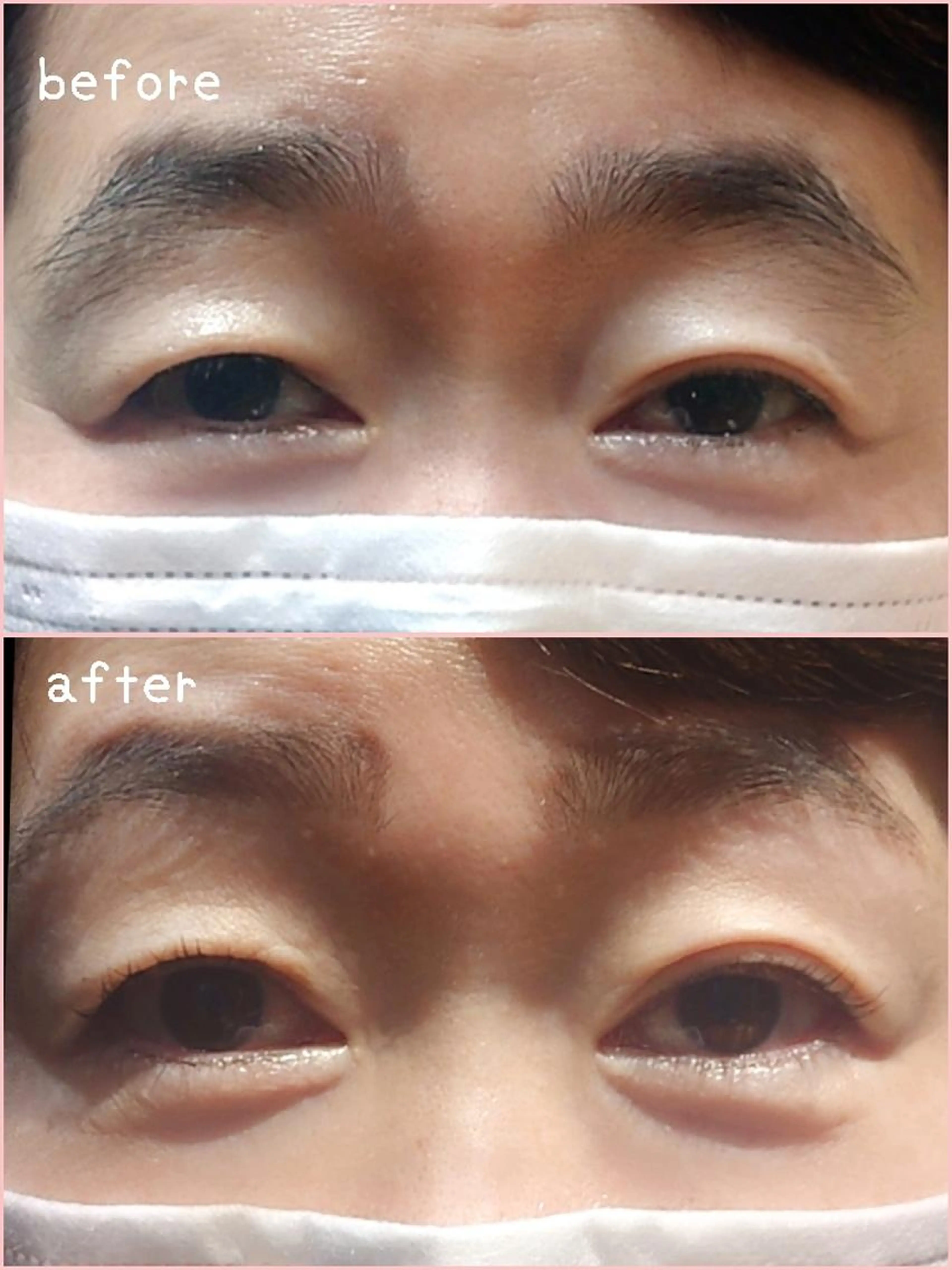 人気No.1🌸パリジェンヌ+アイブロウワックス脱毛🌺¥8800🌺✨の写真