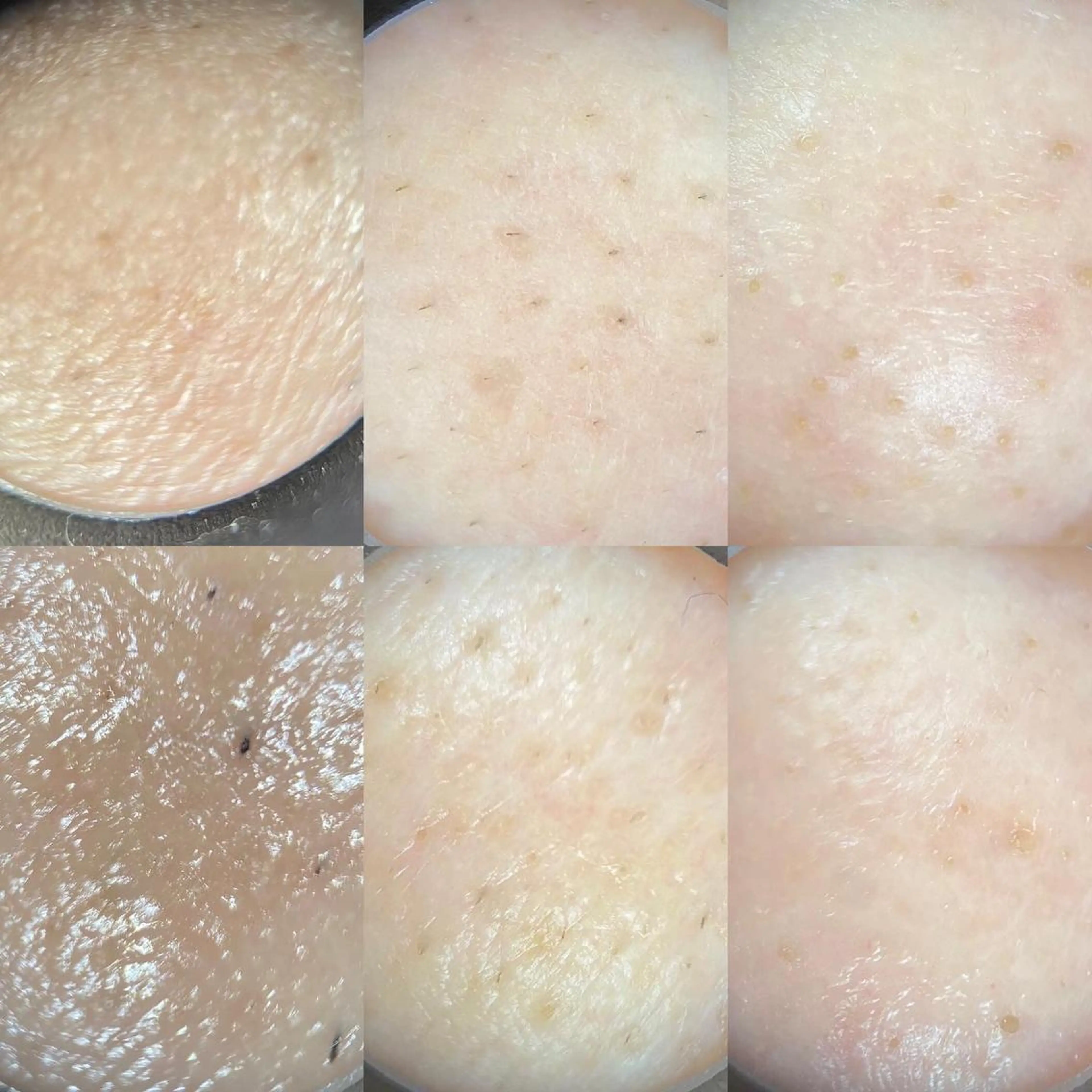 エステ メナードフェイシャルサロン　リンガーデン所属・山口 郁代のエステ・リラクイメージ