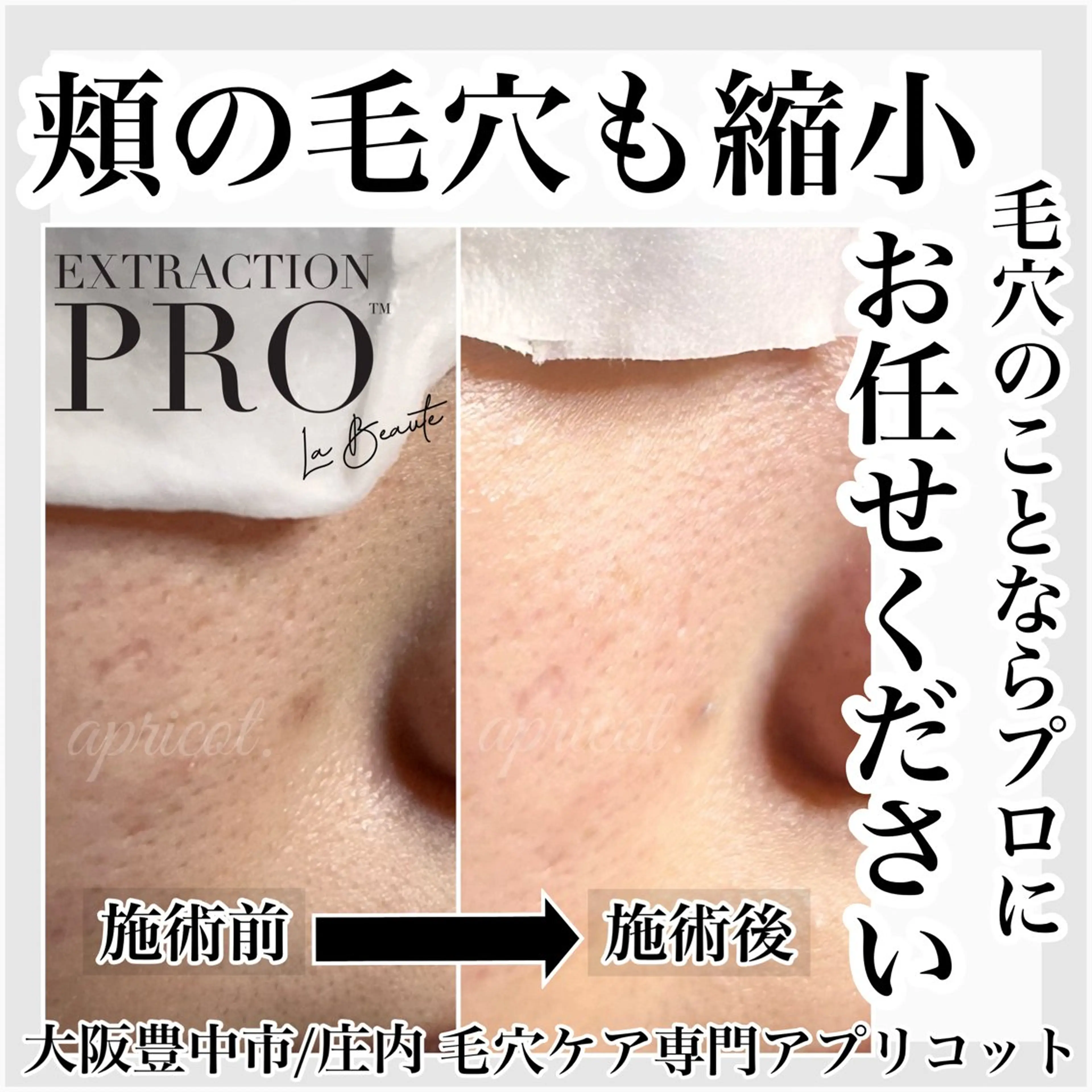 ヘッドスパ専門/豊中 apricotのエステ・リラクイメージ