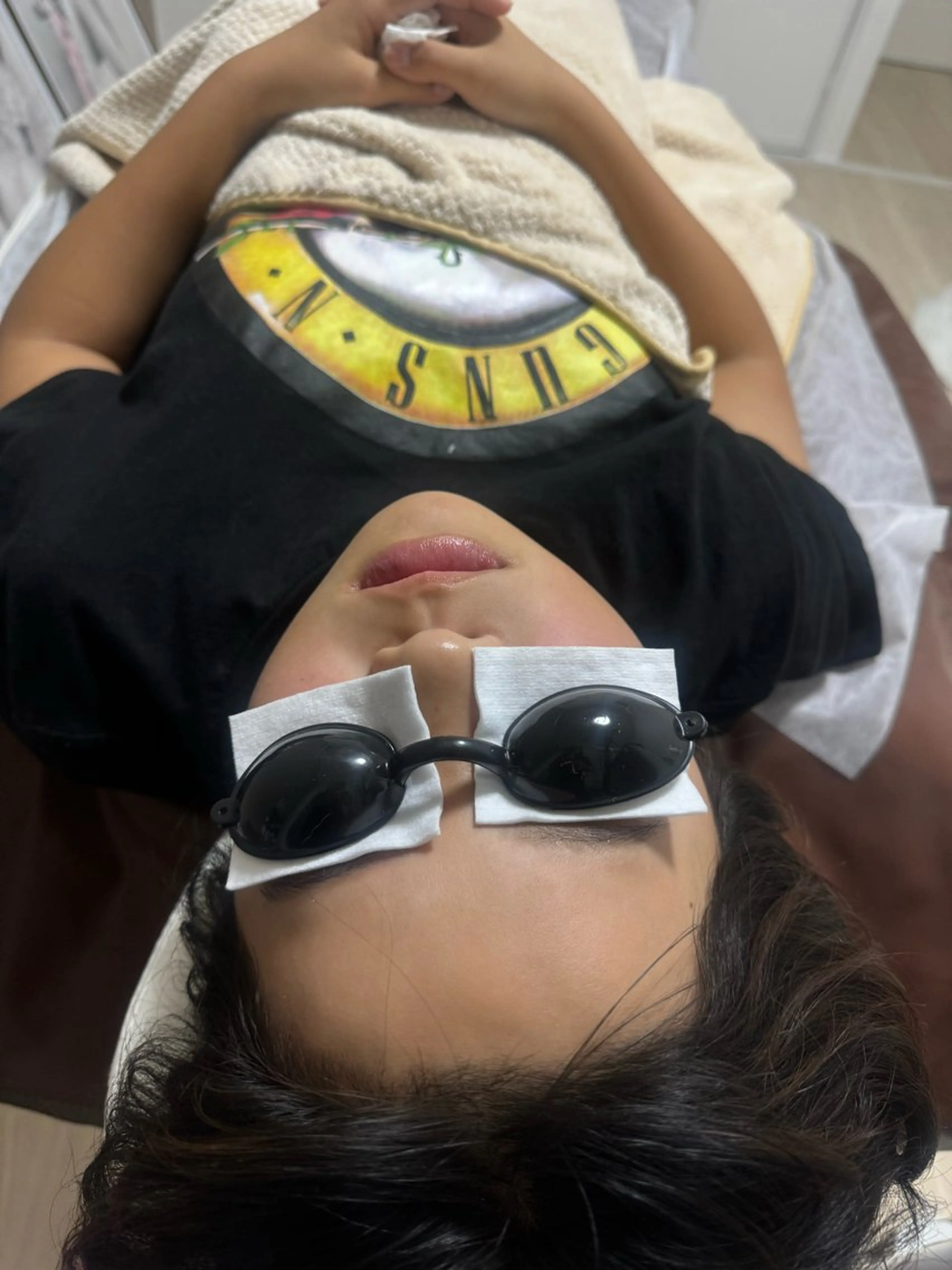 全身脱毛​〜​12歳以下お子様の写真