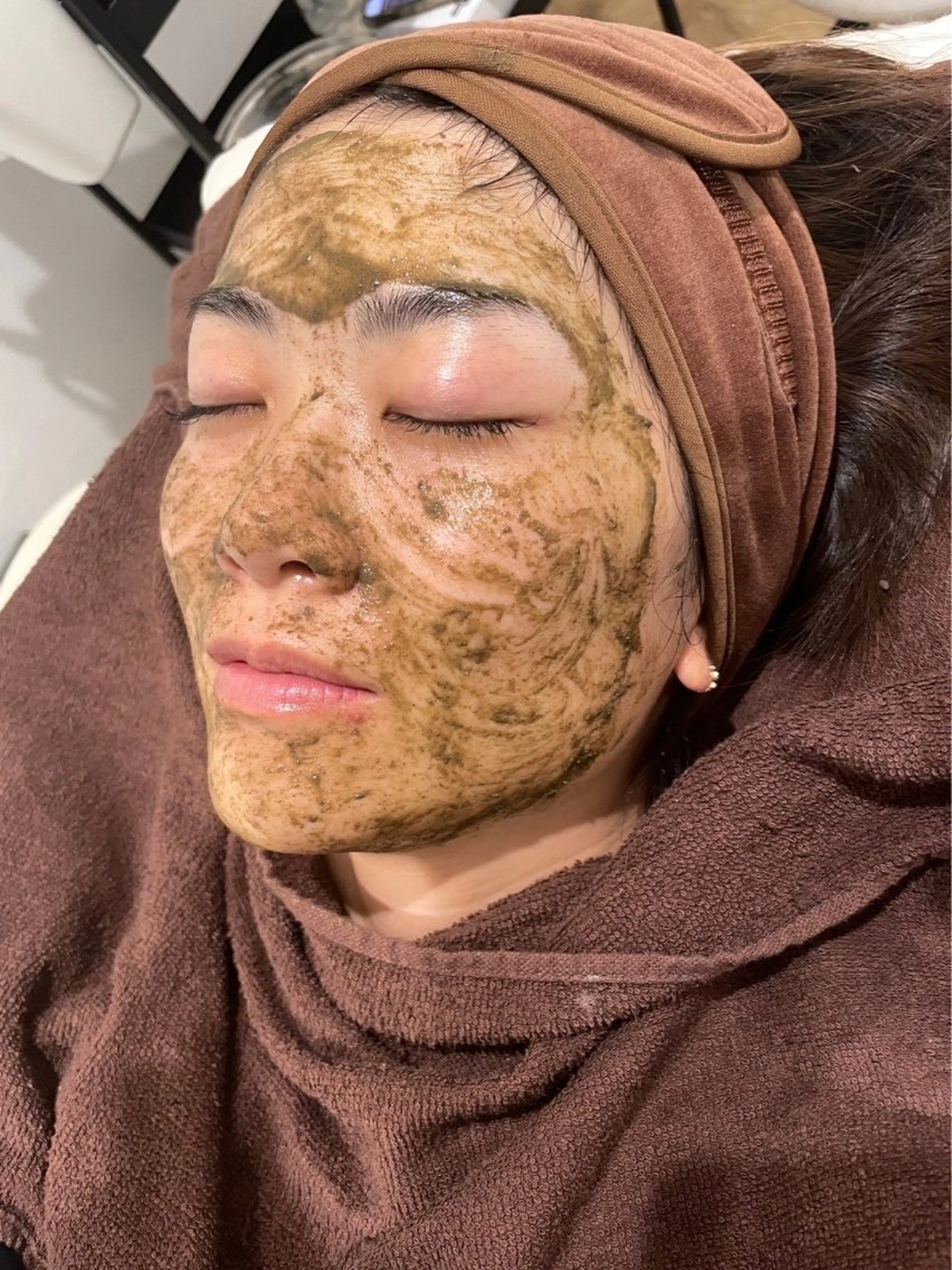 ハーブピーリング　剥離なし　9500円  当日はノーメイクでお越し下さいの写真