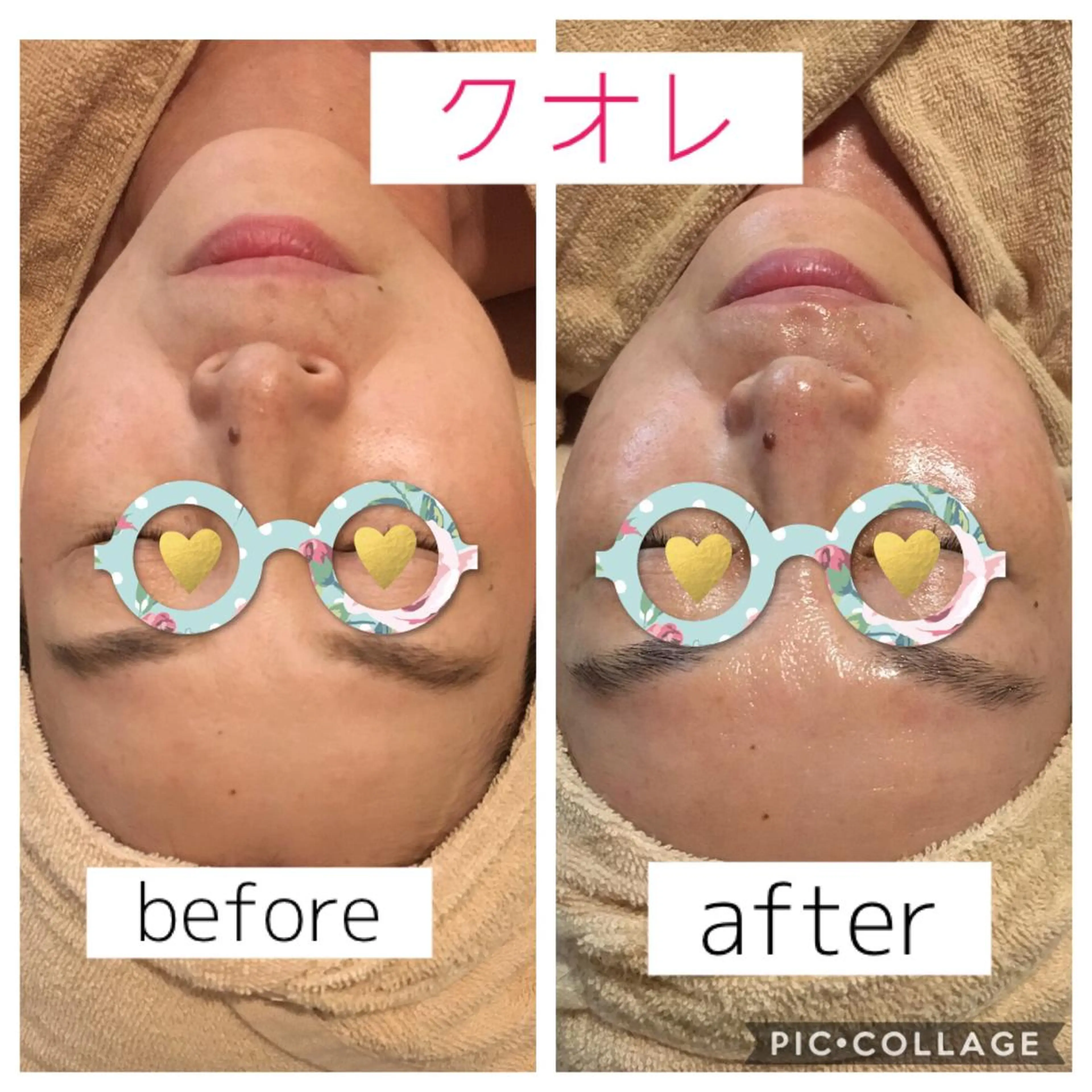 エステ 美肌専門salon クオレのエステ・リラクイメージ