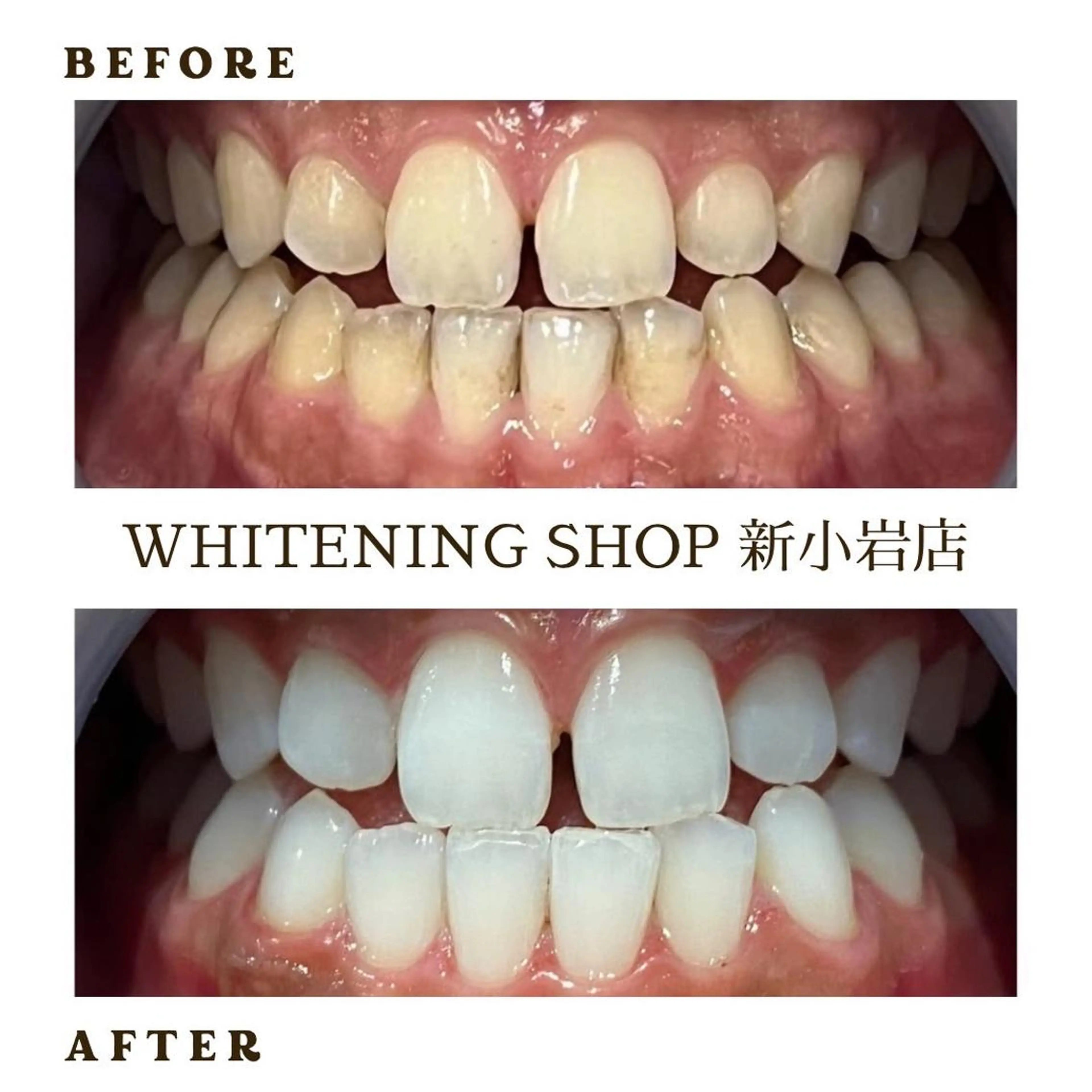 メンズ その他 ホワイトニング ショップ新小岩店のその他イメージ