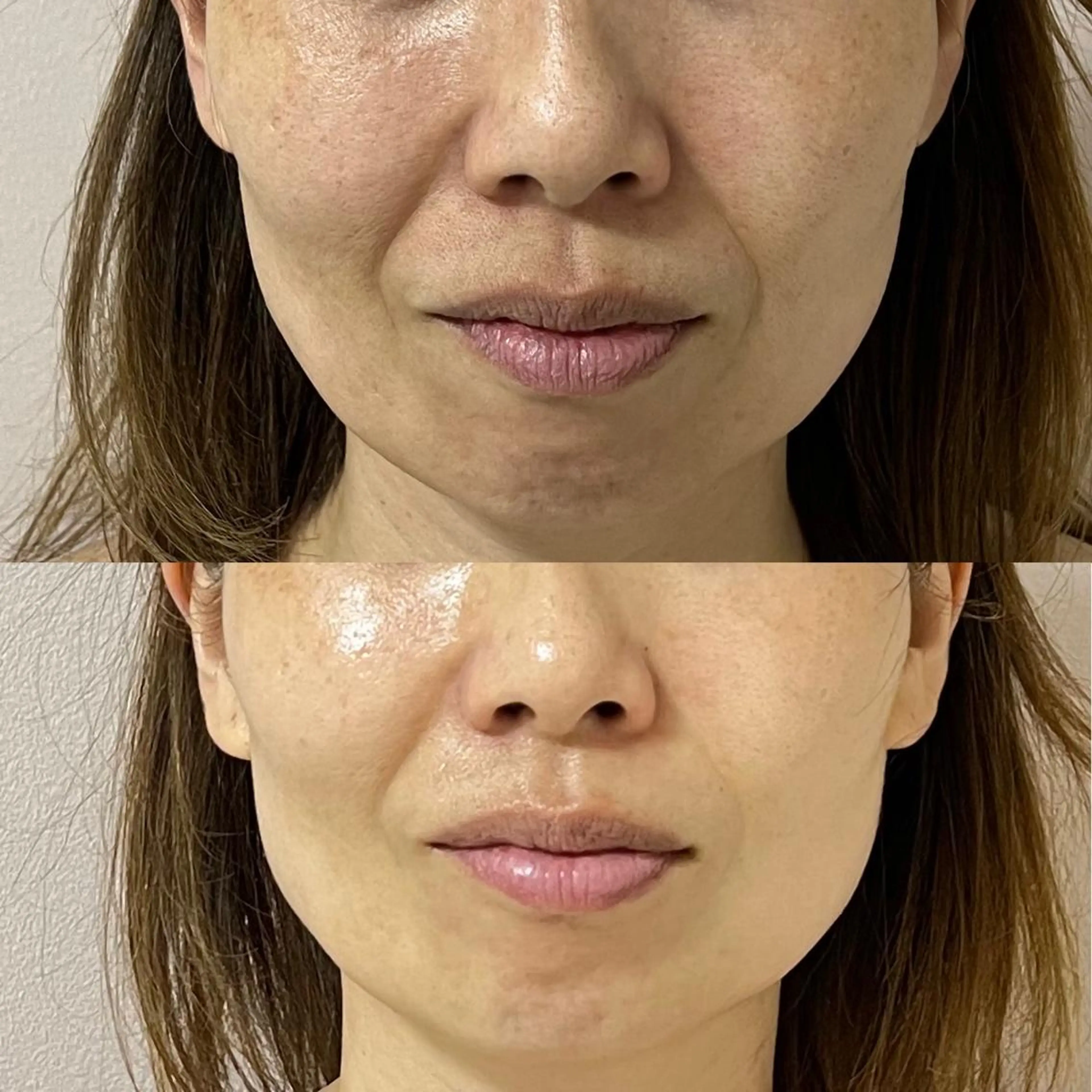 本気の小顔×毛穴ケア ／もりやま はるかのエステ・リラクイメージ