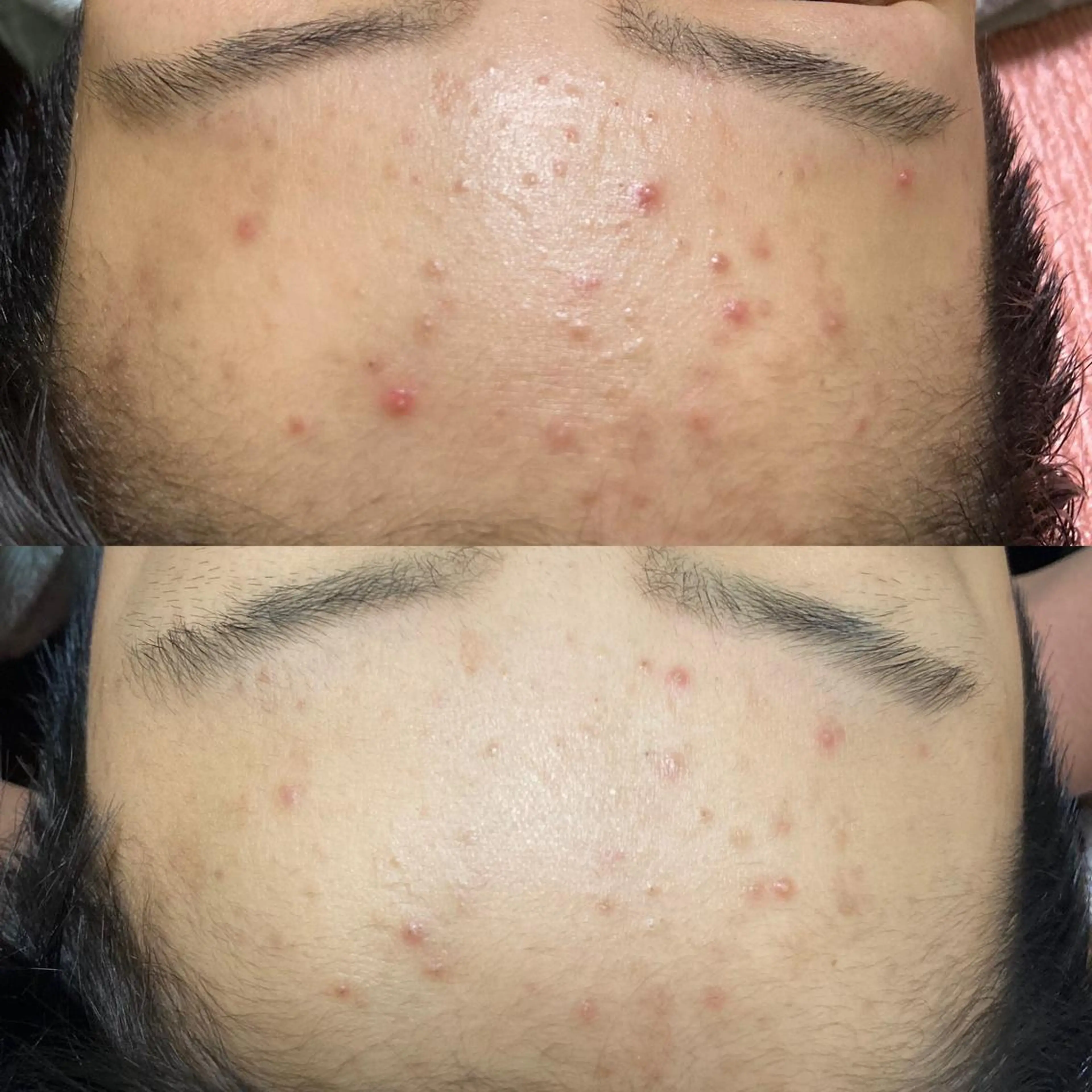 eyelash・aesthetic salon KANARU所属・KANARU ♡真七海♡のマツエク・マツパデザイン