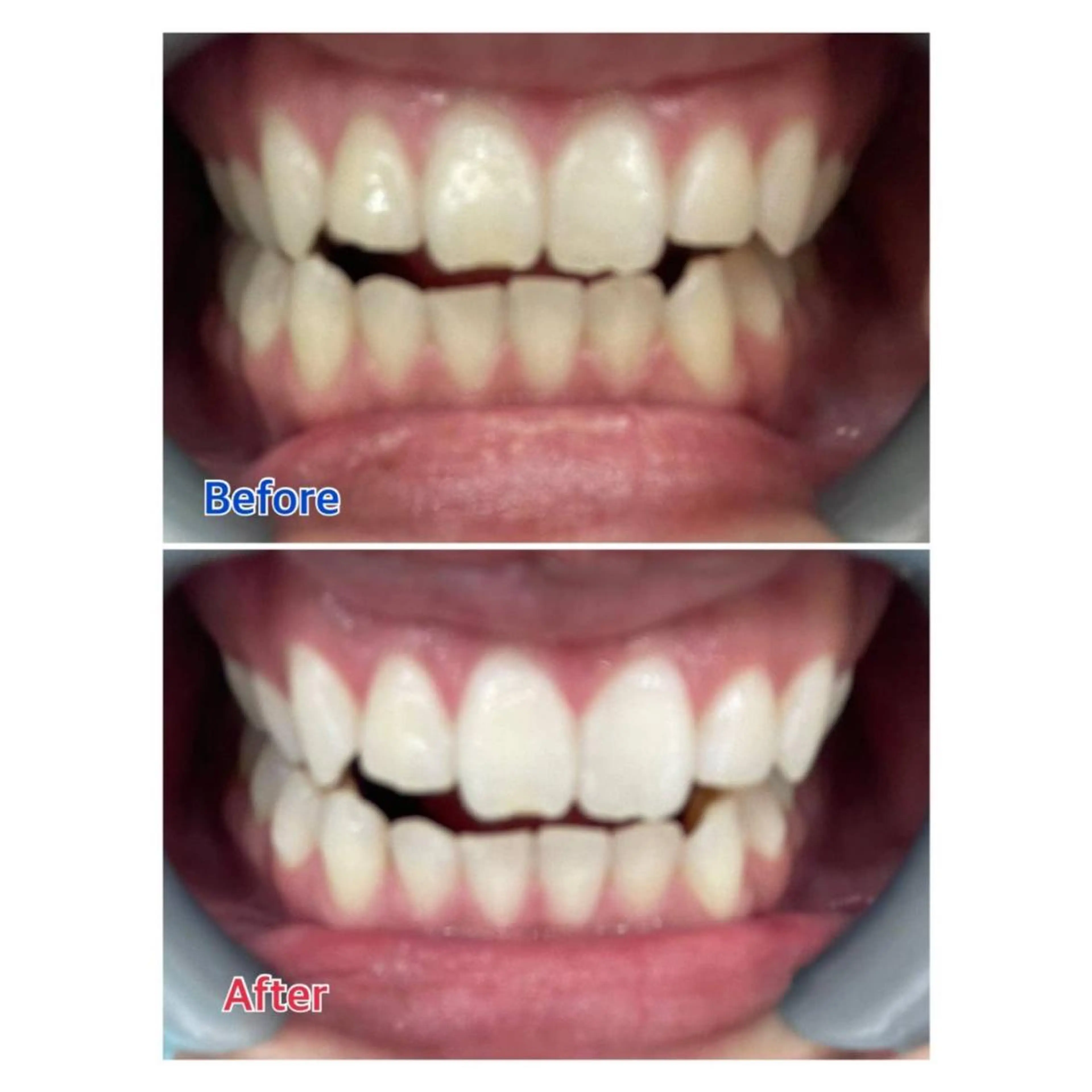 MBEAUTYSALON 千葉店・京成大久保所属・Melty 輝のその他イメージ