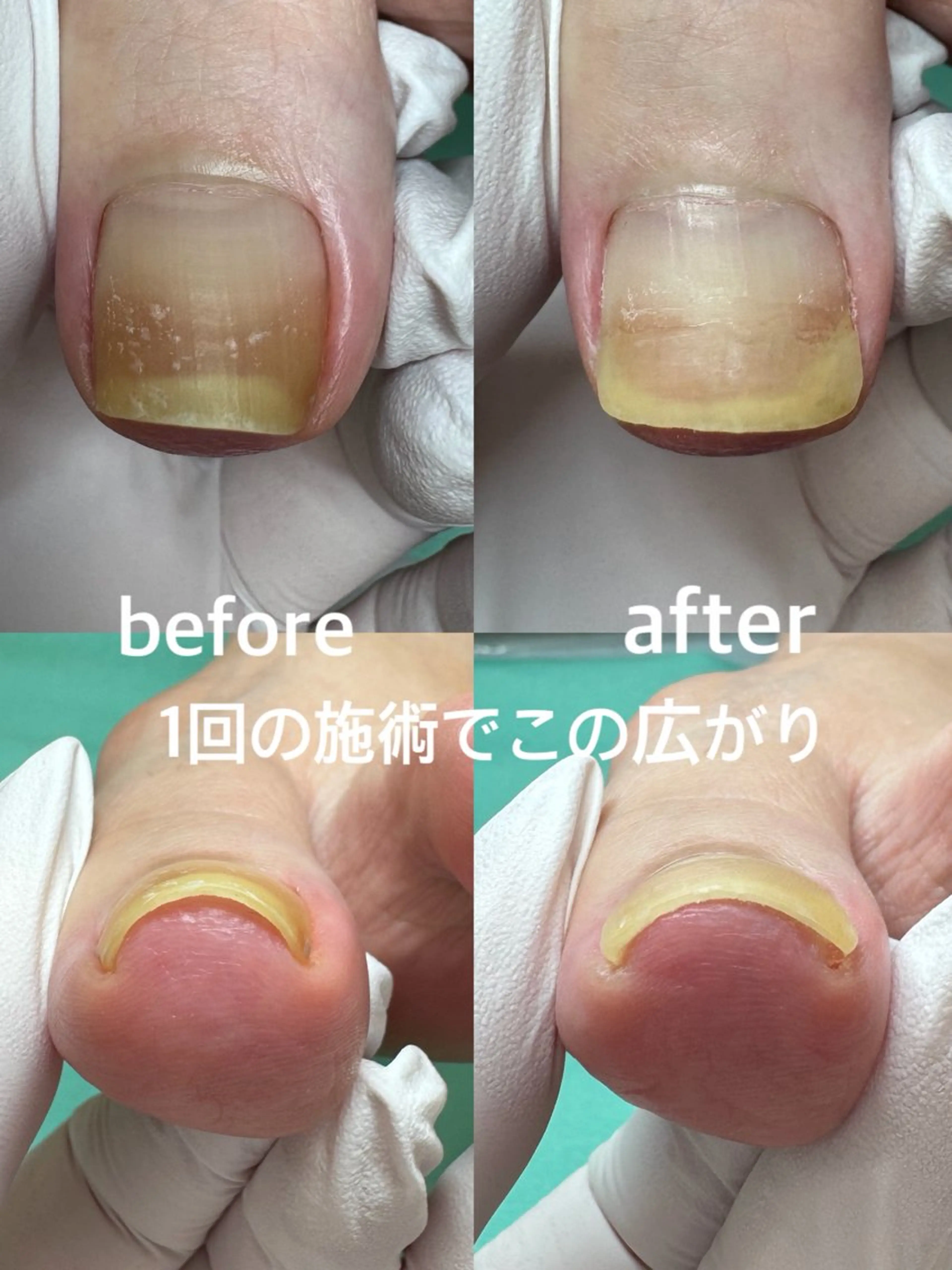 Lise footcareのネイルデザイン