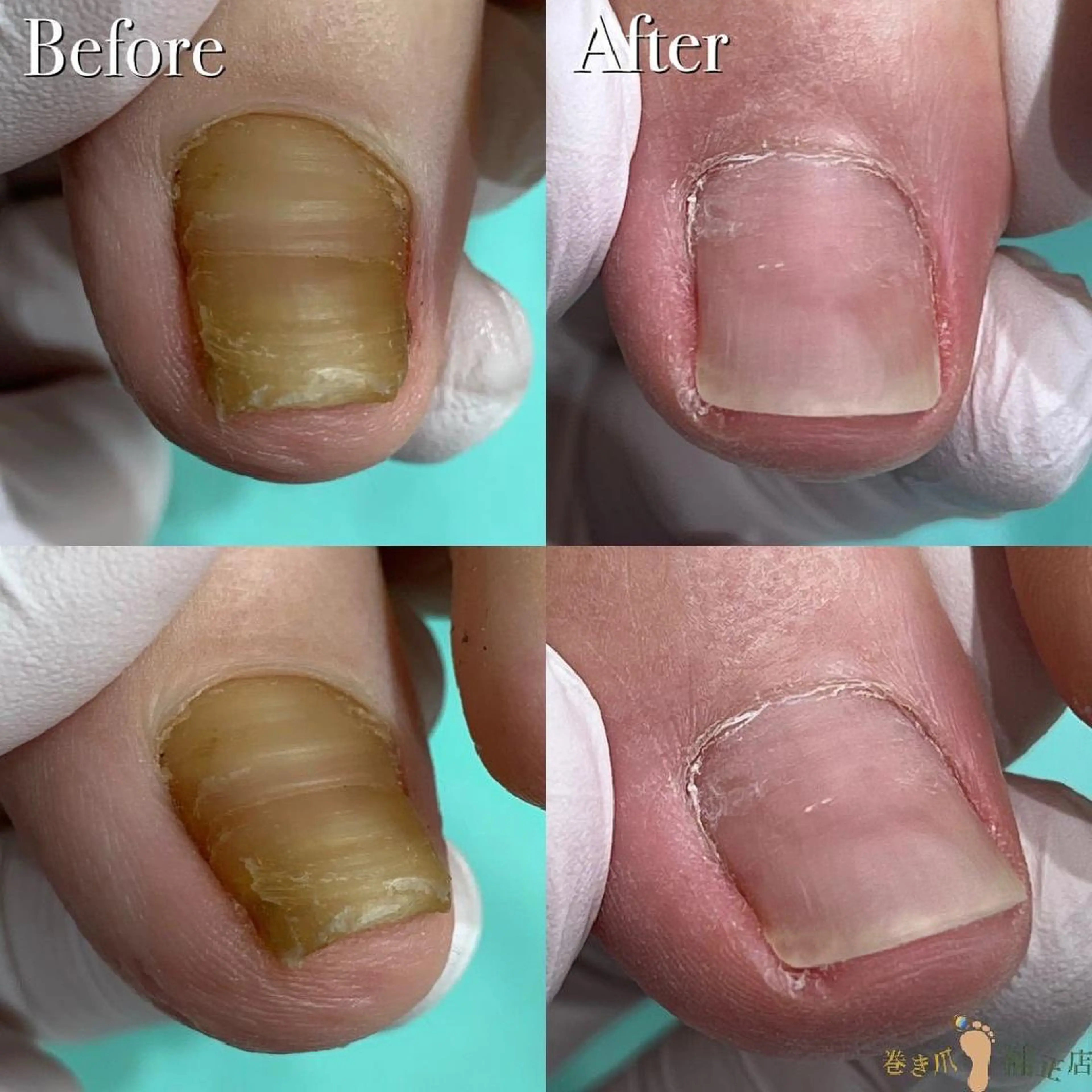 東京巻き爪アカデミー所属・東京巻き爪 アカデミーのエステ・リラクイメージ