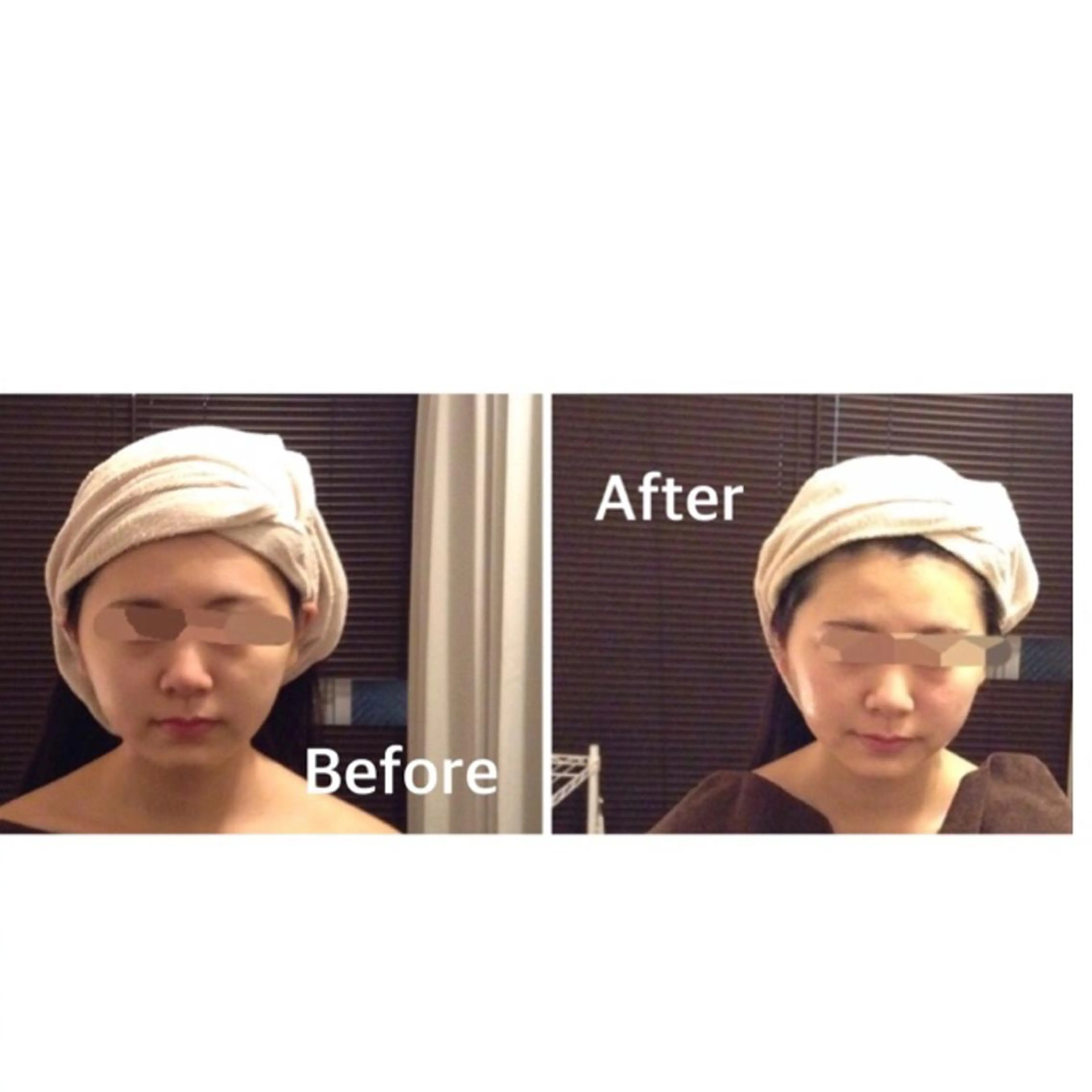 小尻・太もも痩せる エステルナボーテのエステ・リラクイメージ