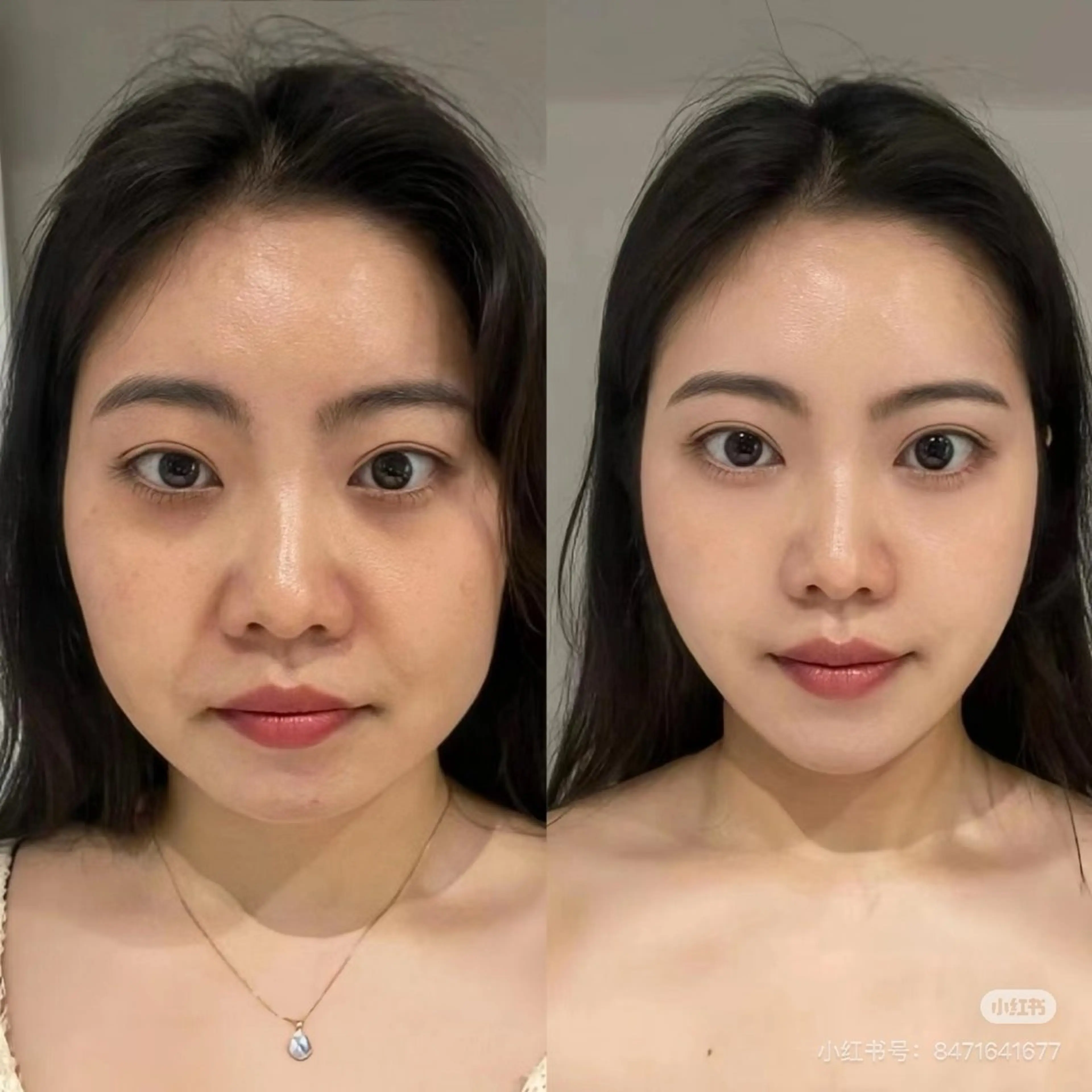 ネイル エステ aliaハイフ&水光ジェットサロン所属・aliaハーブ水光店 エステティシャン募集のエステ・リラクイメージ