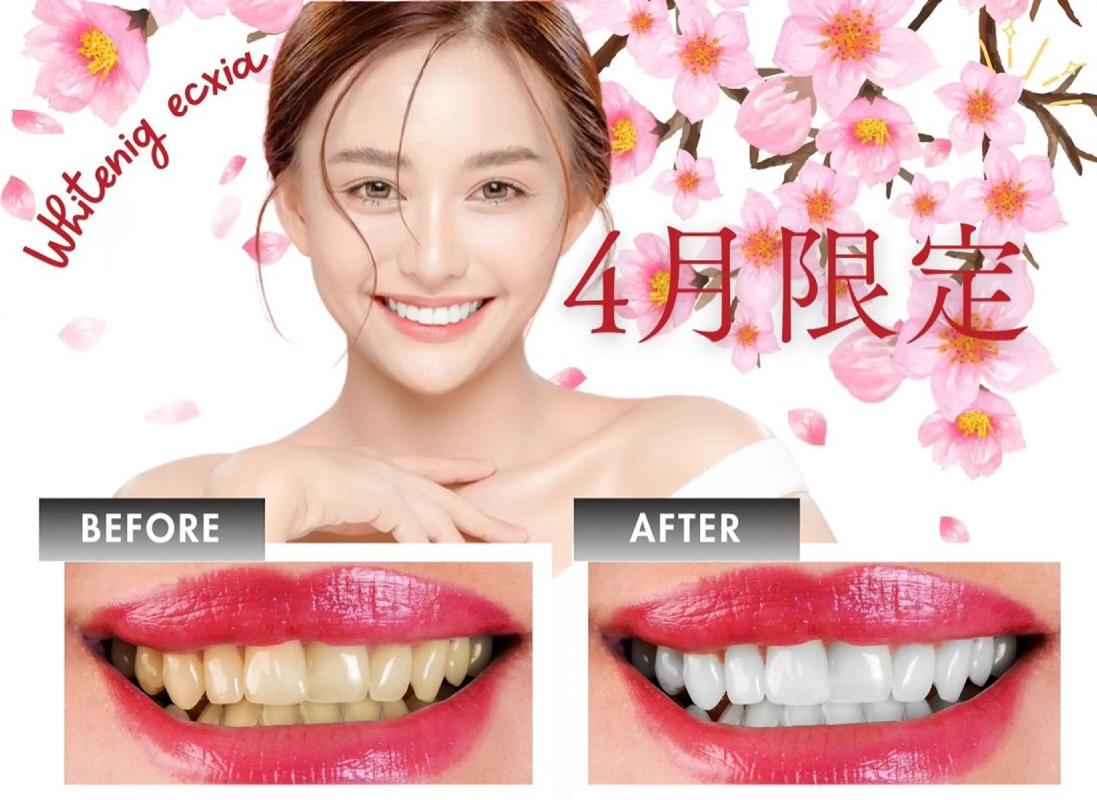 ecxia white 高田馬場所属・セルフホワイトニング エクシア 高田馬場のその他イメージ