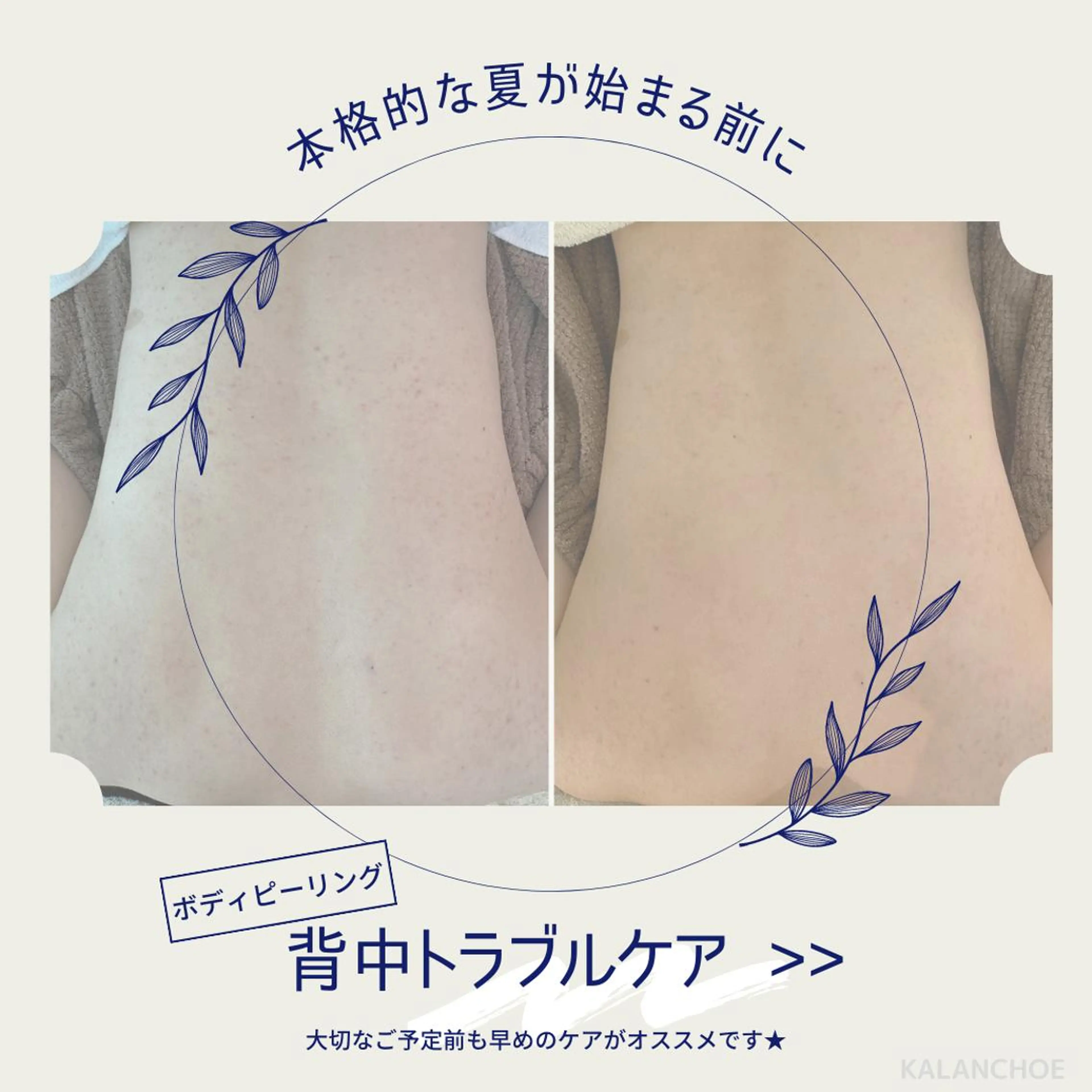 エステ リラク 肌質改善 KALANCHOEのエステ・リラクイメージ