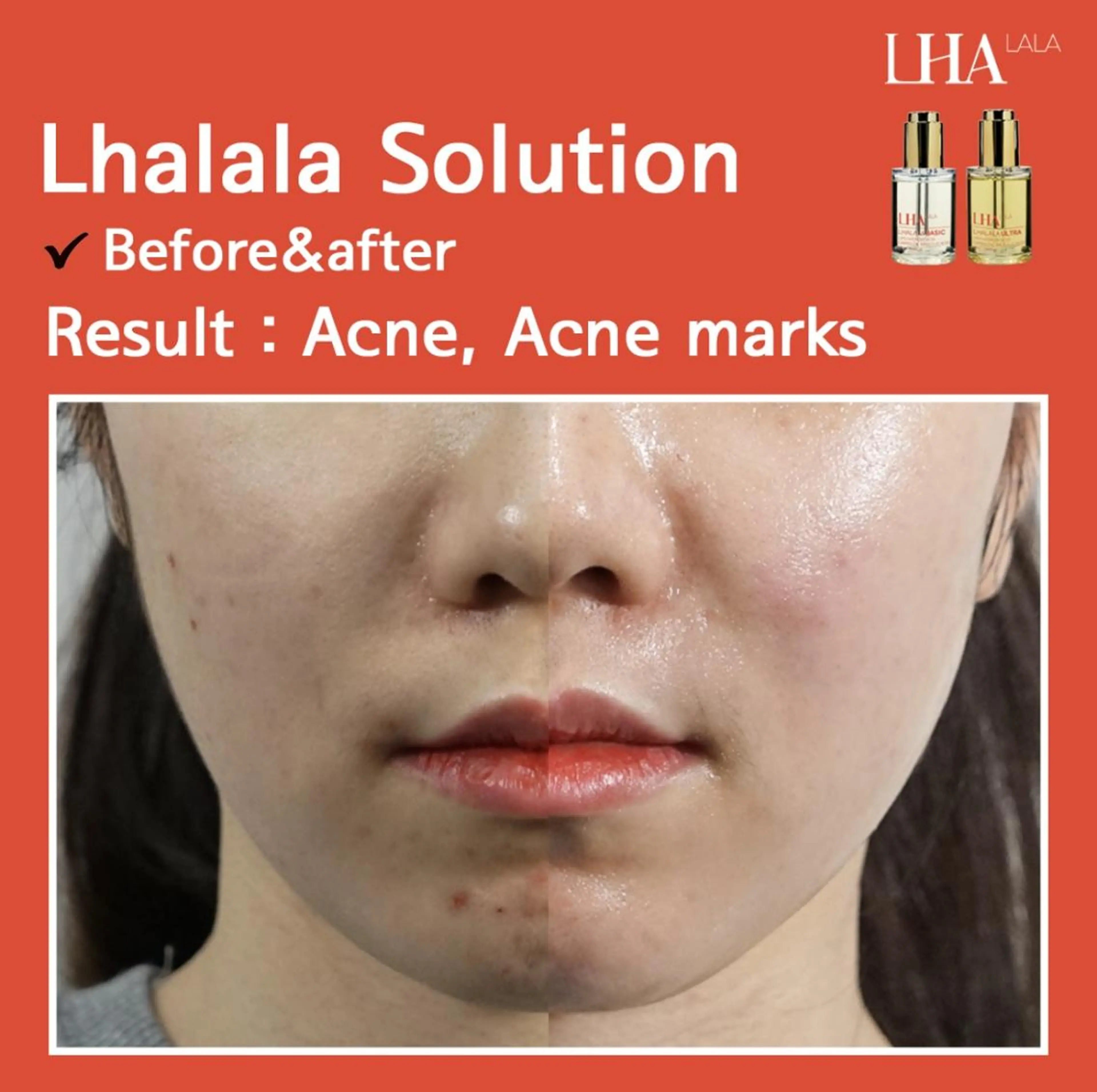 メンズ Epina 千葉店 【エピナ】のエステ・リラクイメージ