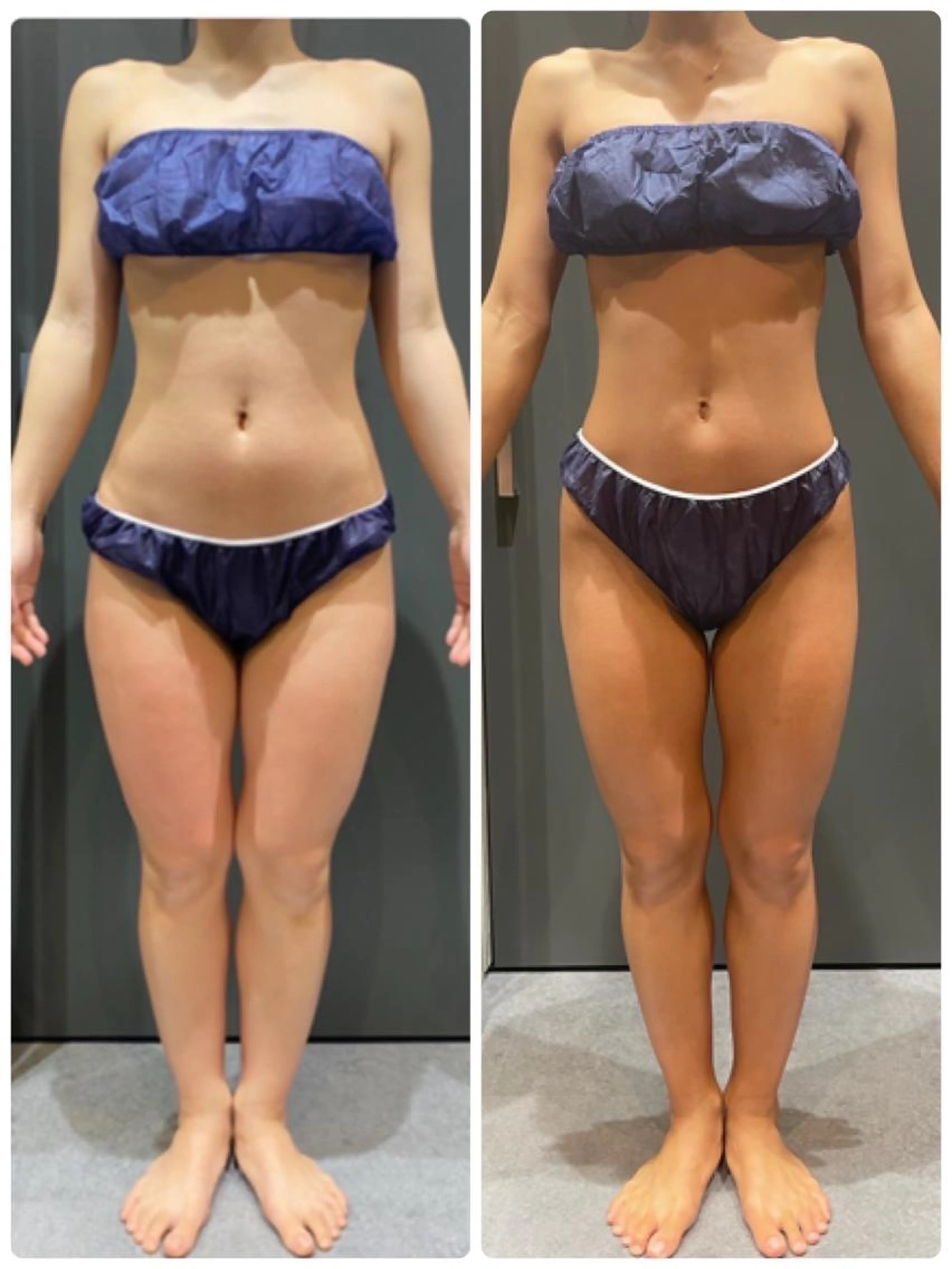 U24限定🎄クリスマスまでに全身ケア🔥くびれ肩こりむくみセルライトケアの写真