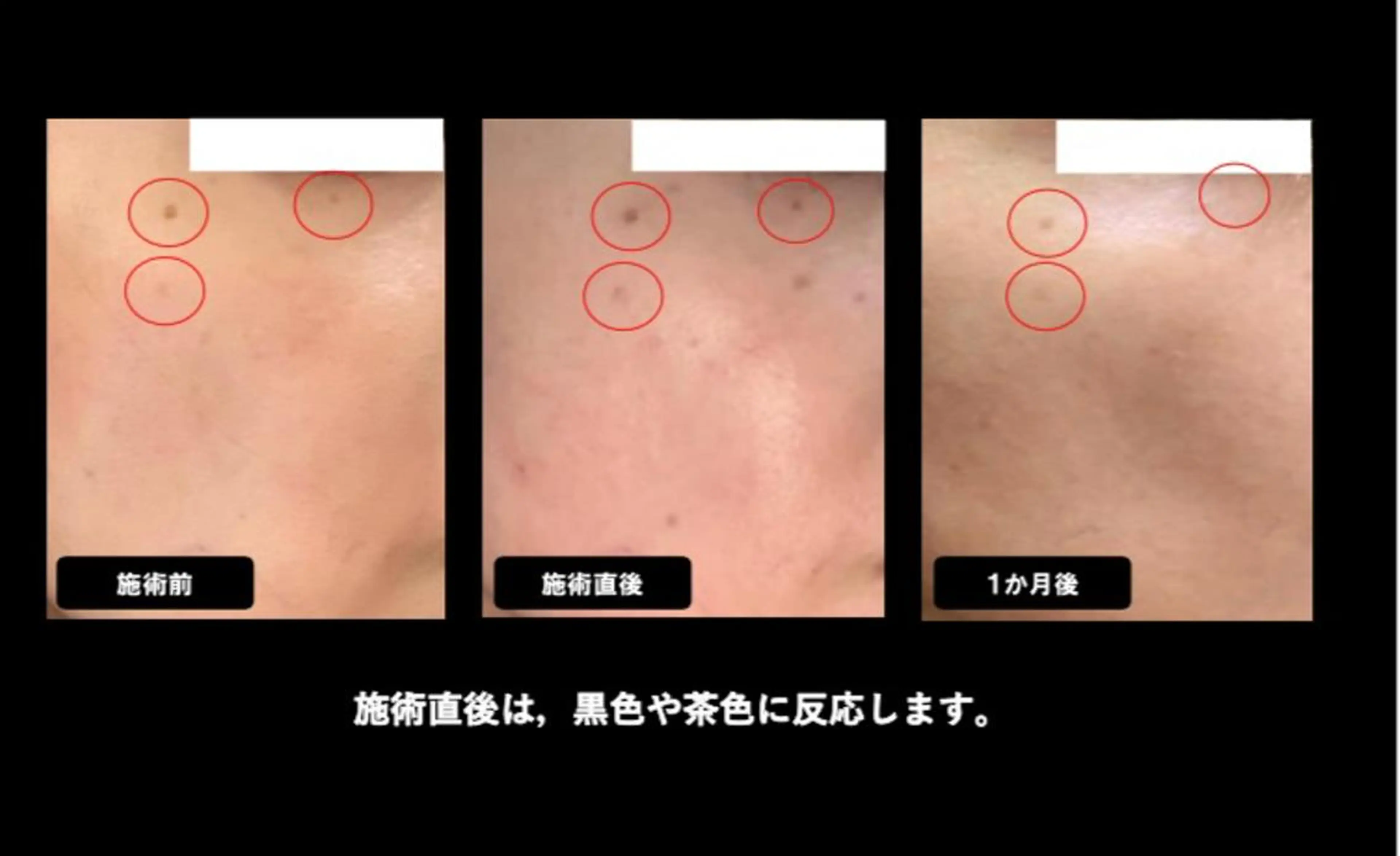 ヴィーナス ビューティーのエステ・リラクイメージ